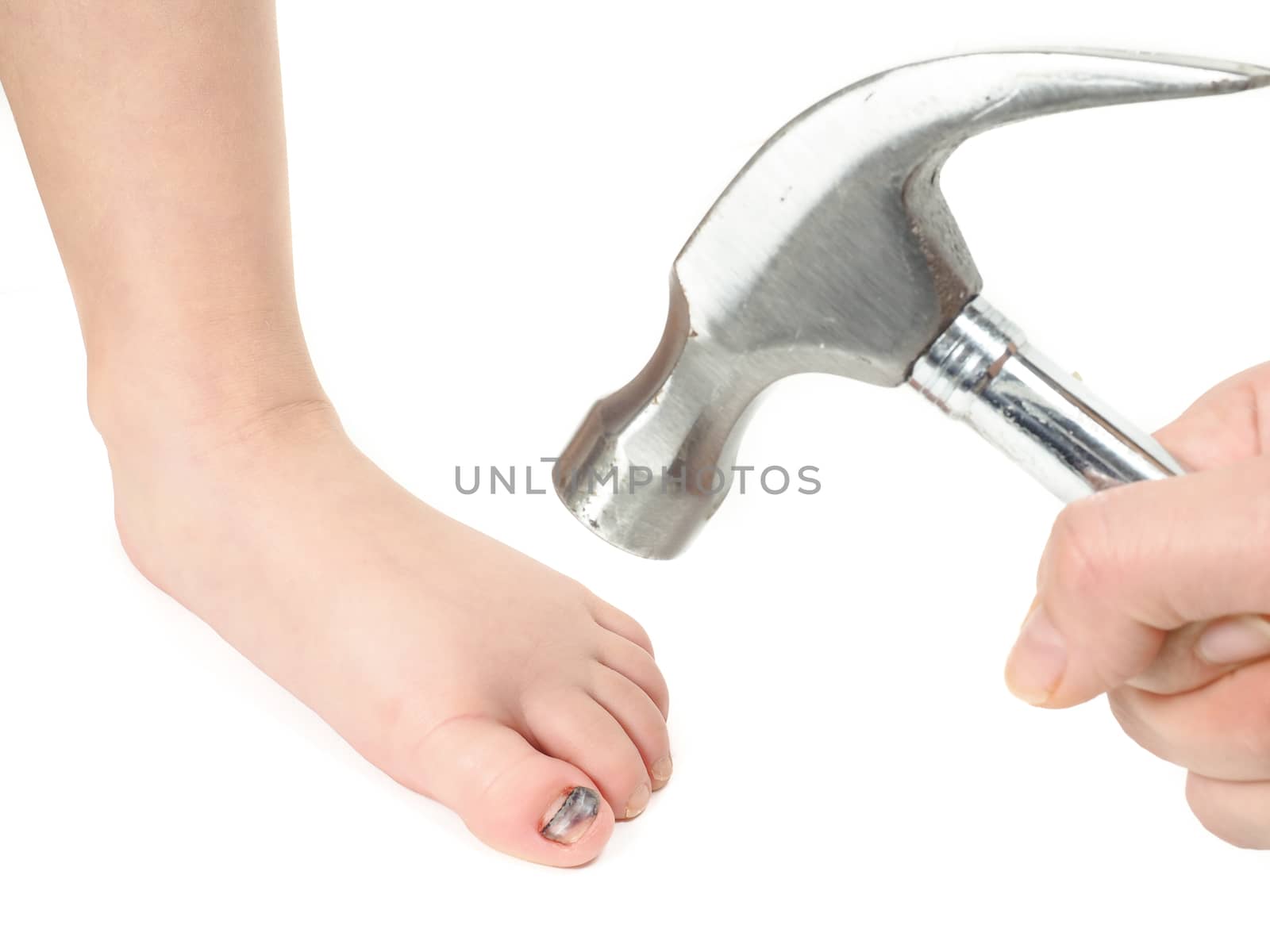 Someone holding a hammer over a child's foot with blue hallux nail after injury