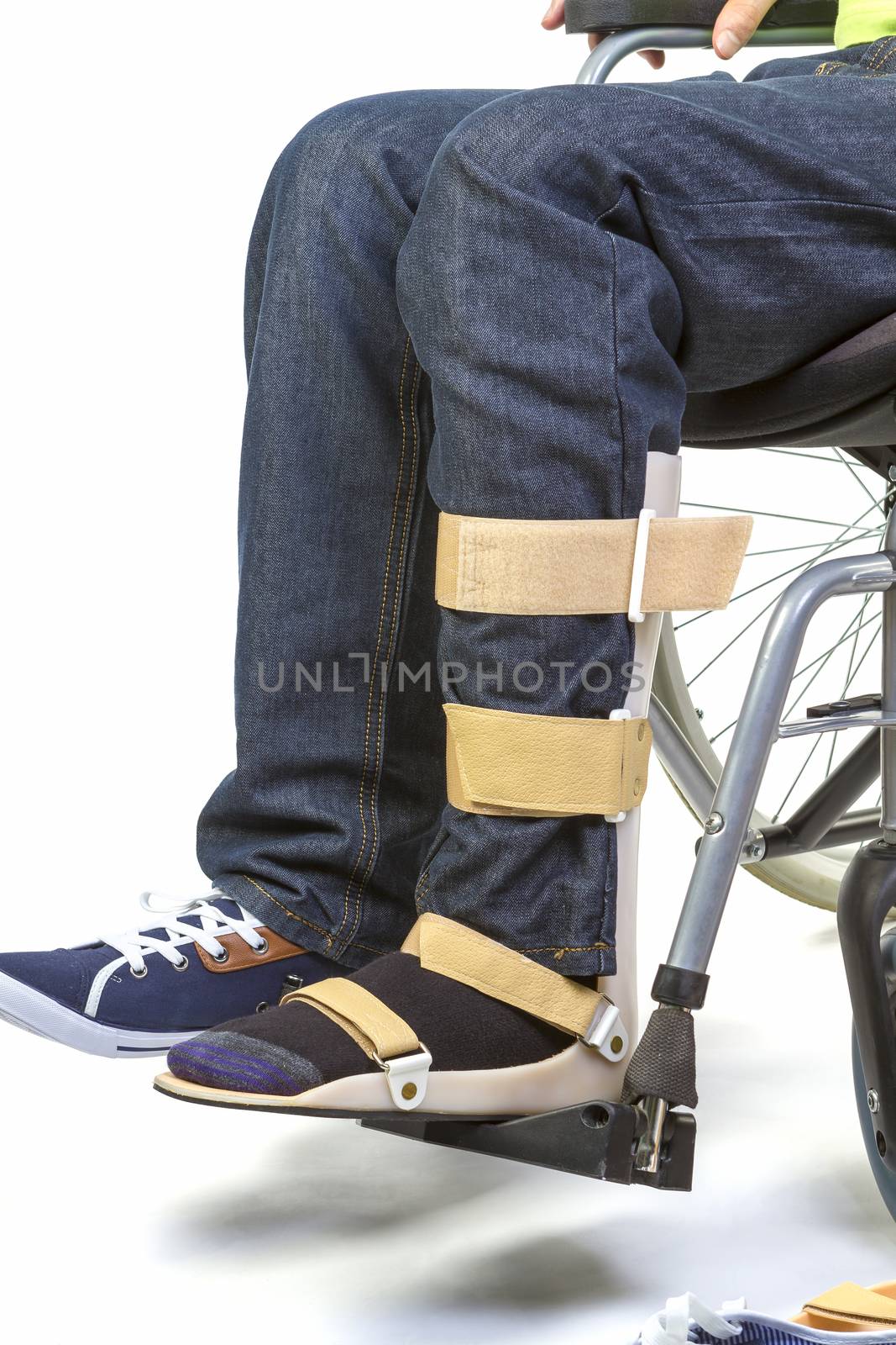 Orthopedist puts orthosis to patient in wheelchair with disabilities