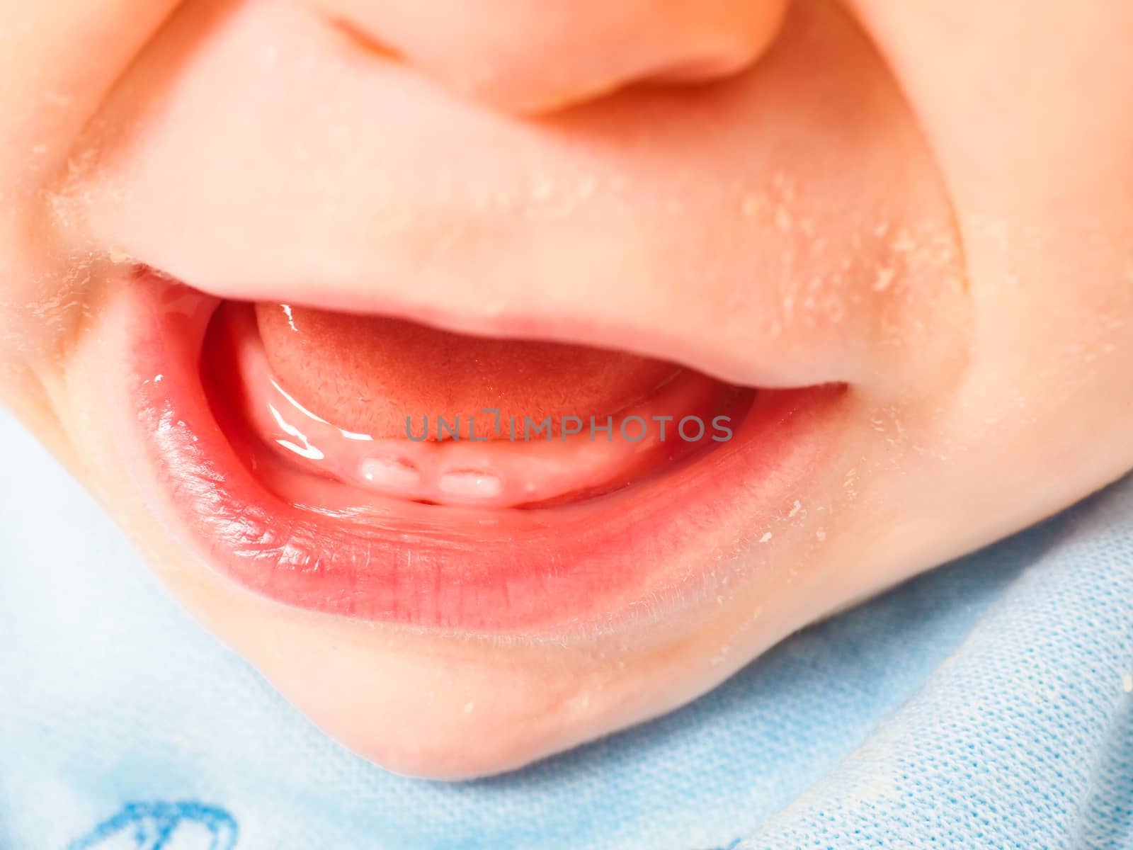 Baby boy showing first teeth with mouth wide open by Arvebettum