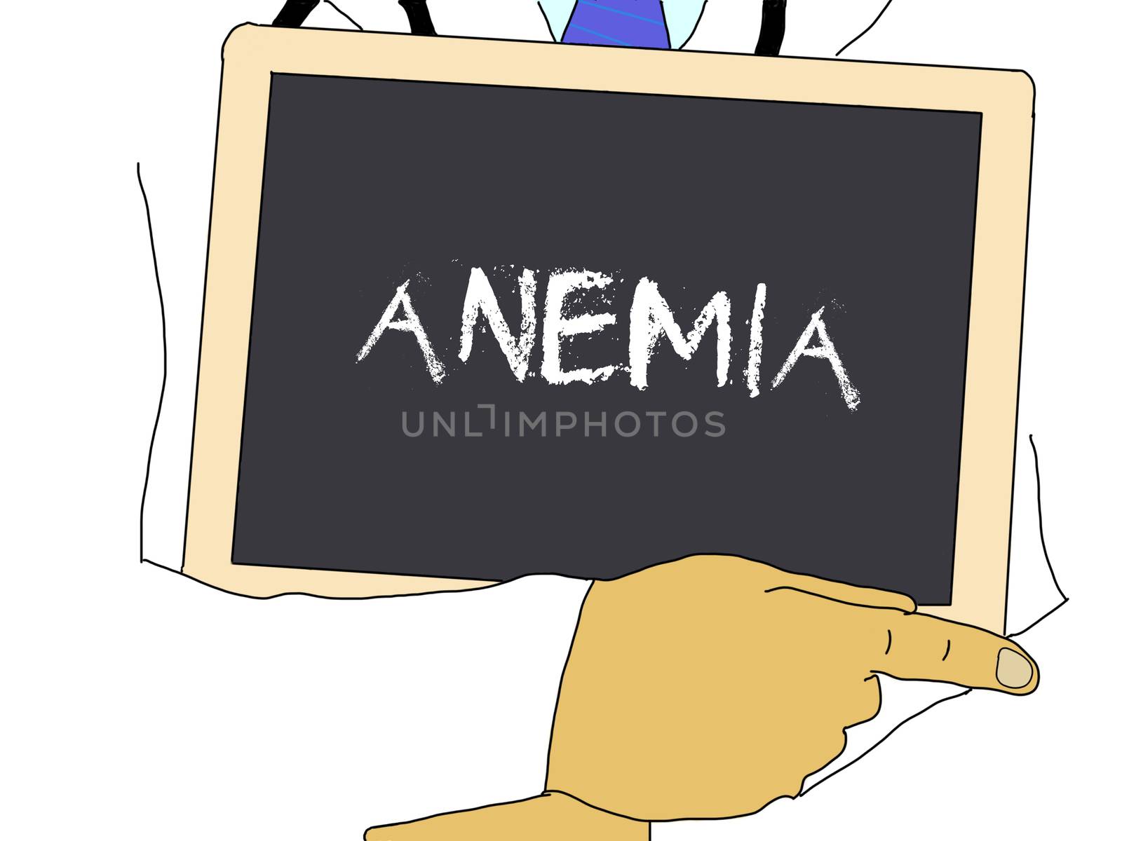 Illustration: Doctor shows information: anemia