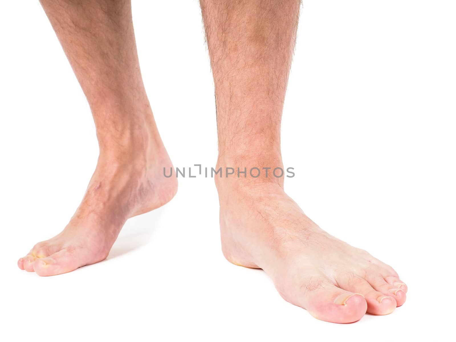 Male person with hairy legs, walking barefooted towards, against white background