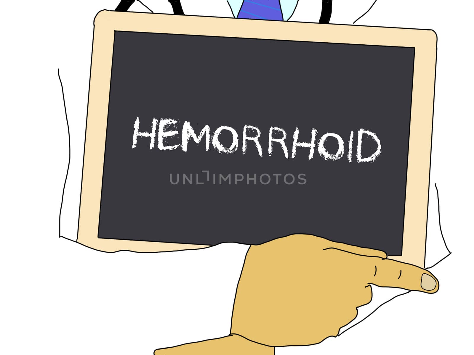 Illustration: Doctor shows information: hemorrhoid
