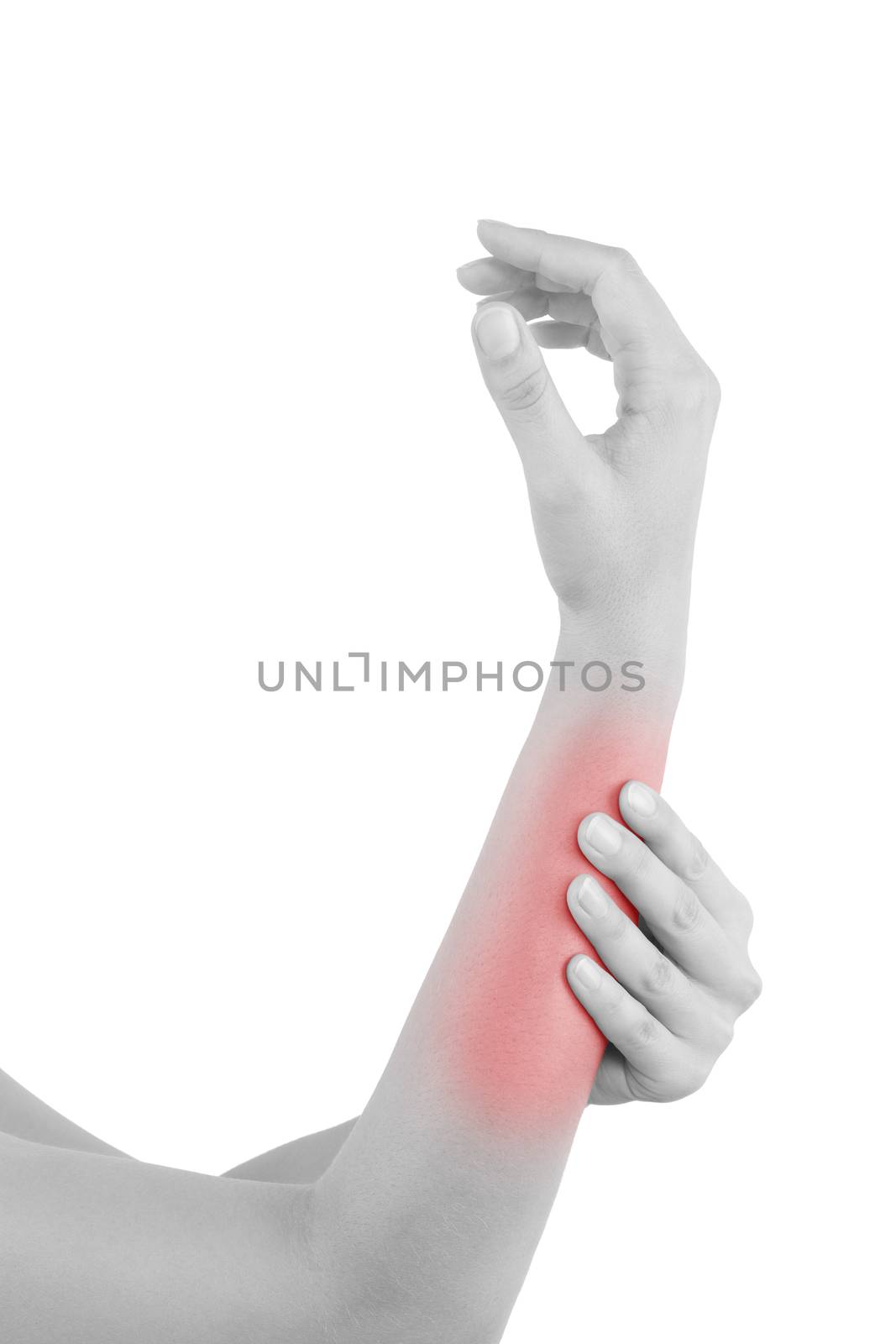 Forearm muscle strain by eskymaks