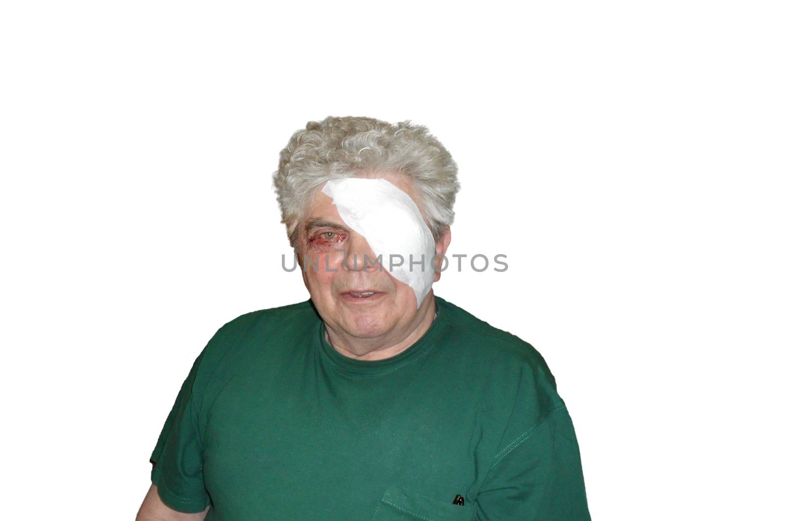 Man with a blindfold after an eye surgery