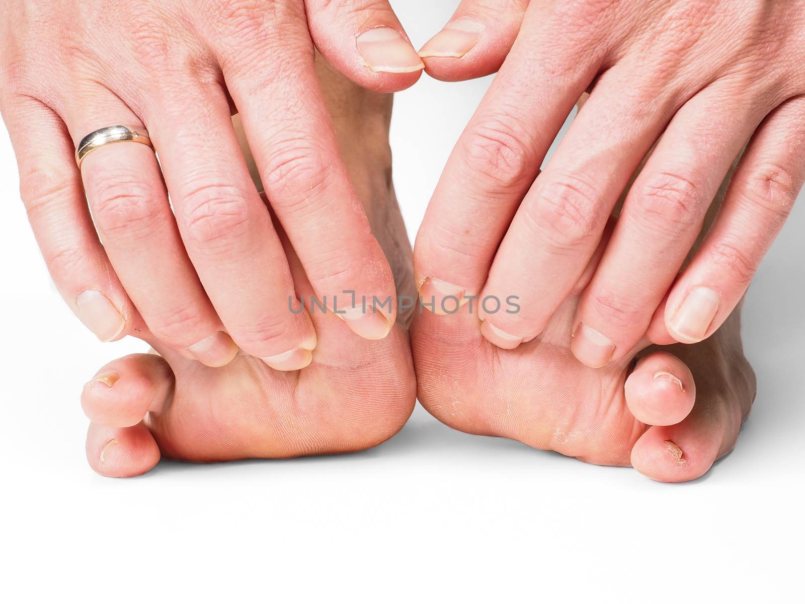 Hands pulling toes on barefoot feet by Arvebettum