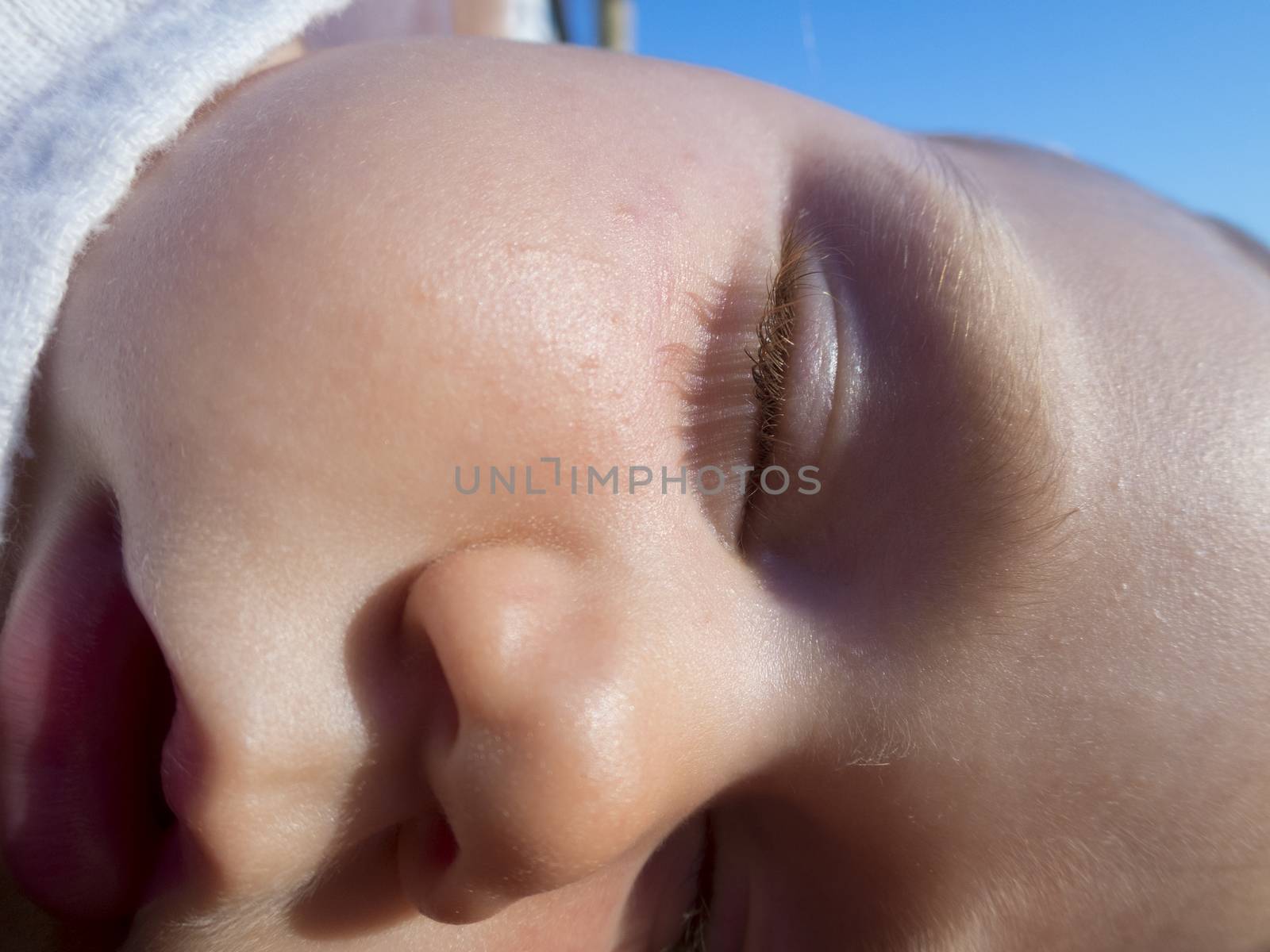 close-up face of baby eye nose mouth sleeping with irritated skin and grains