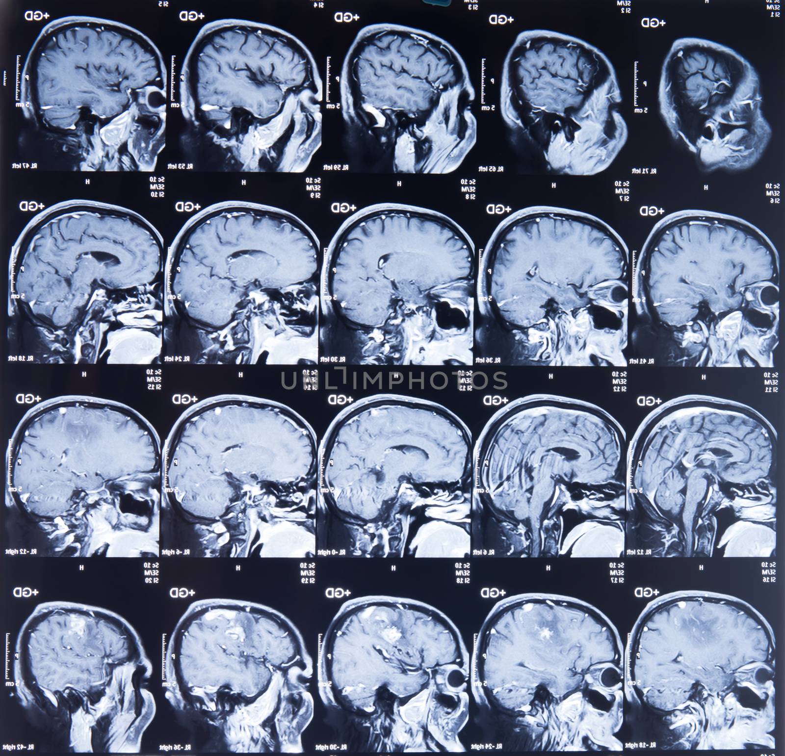 mri scan image by anankkml