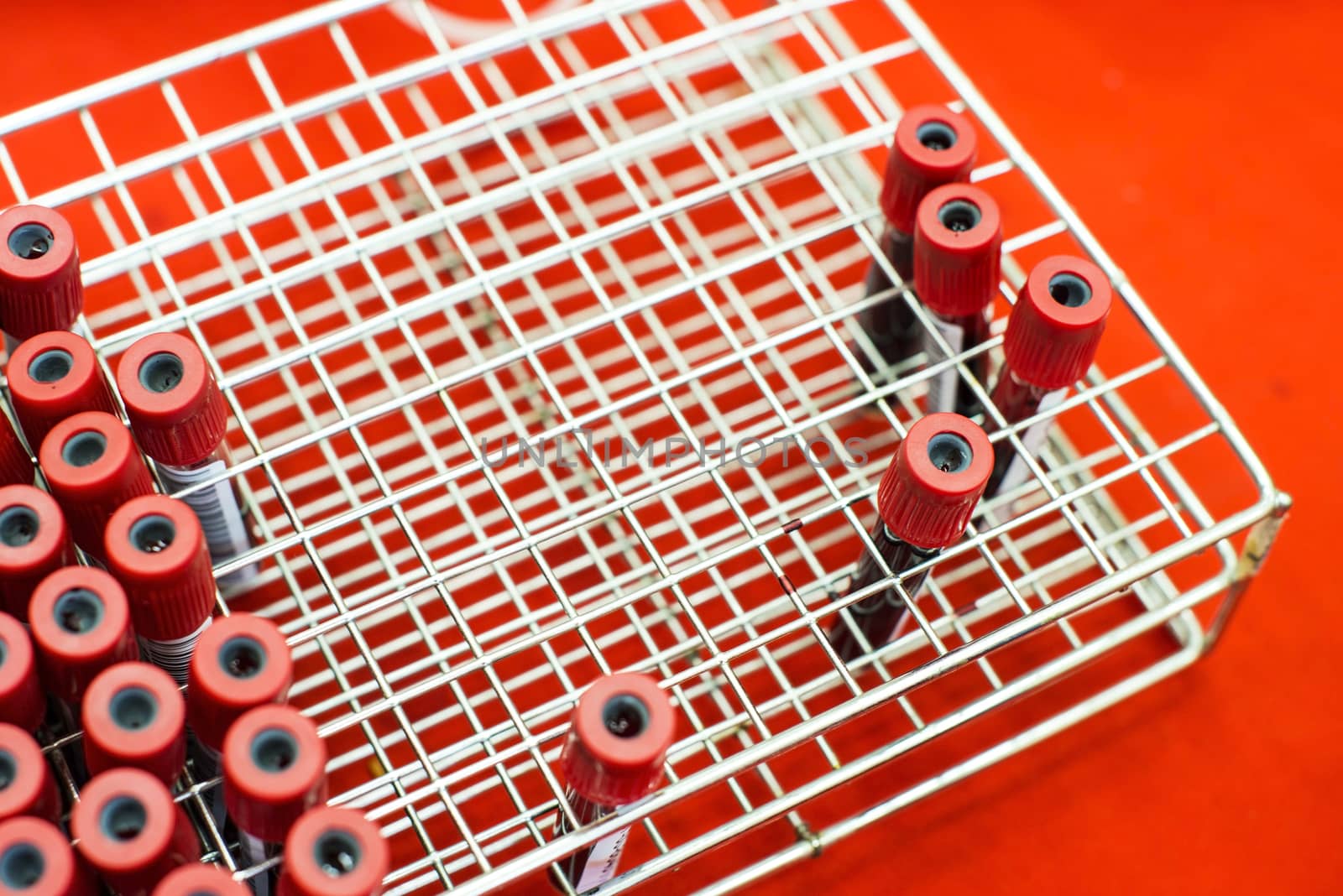 Rack of tubes with blood samples, laboratory microscope and laboratory