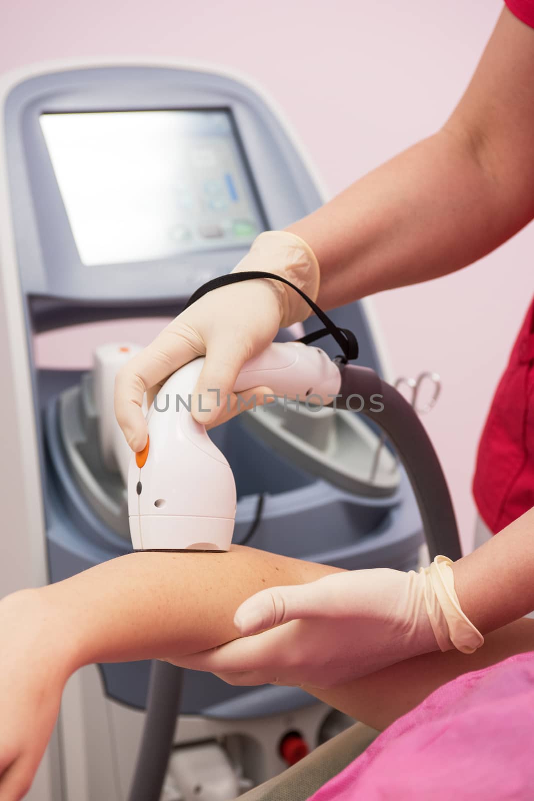 Laser epilation or photo epilation of woman hand