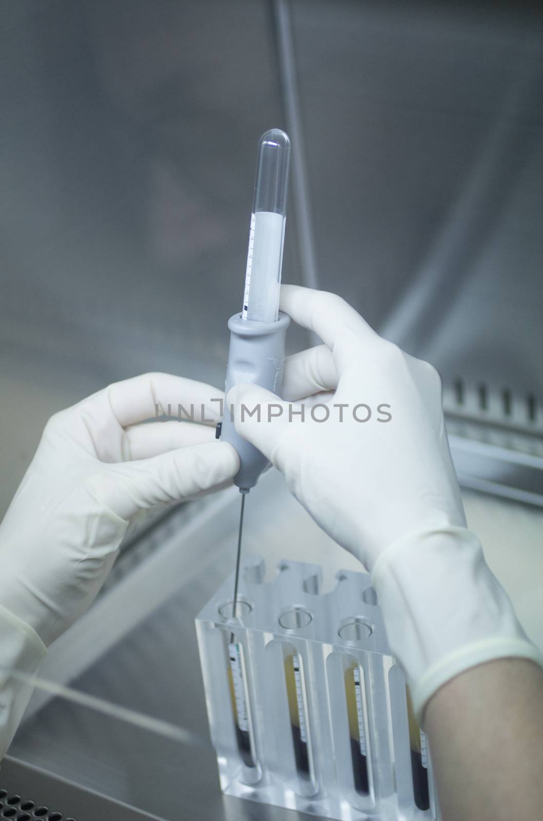 Hands of medical laboratory technician wearing white sterile gloves preparing human growth factors in hospital clinic for orthopedic surgery and Traumatology rehabilitation treatment with syringe injection and test tubes.