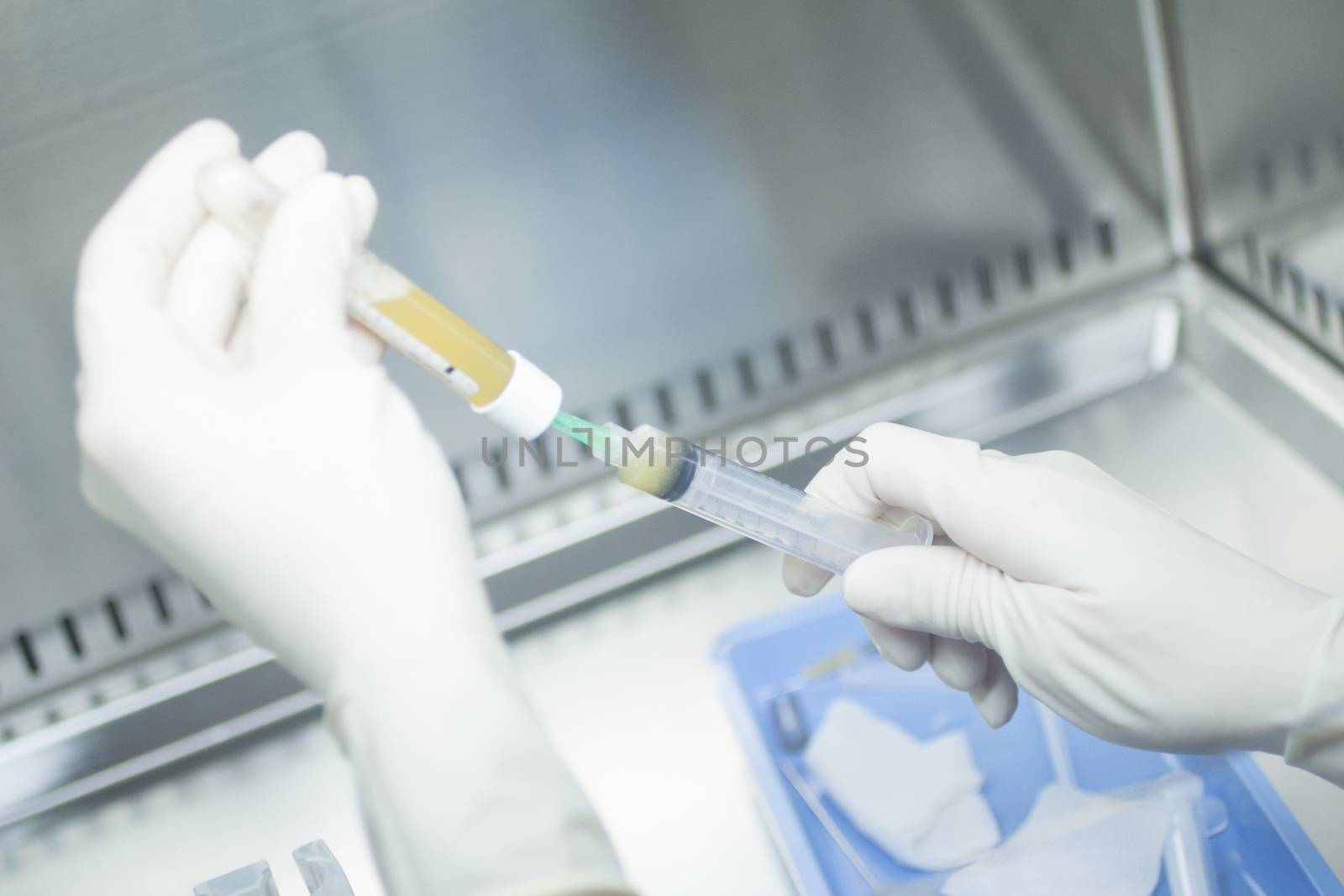 Hands of medical laboratory technician wearing white sterile gloves preparing human growth factors in hospital clinic for orthopedic surgery and Traumatology rehabilitation treatment with syringe injection and test tubes.