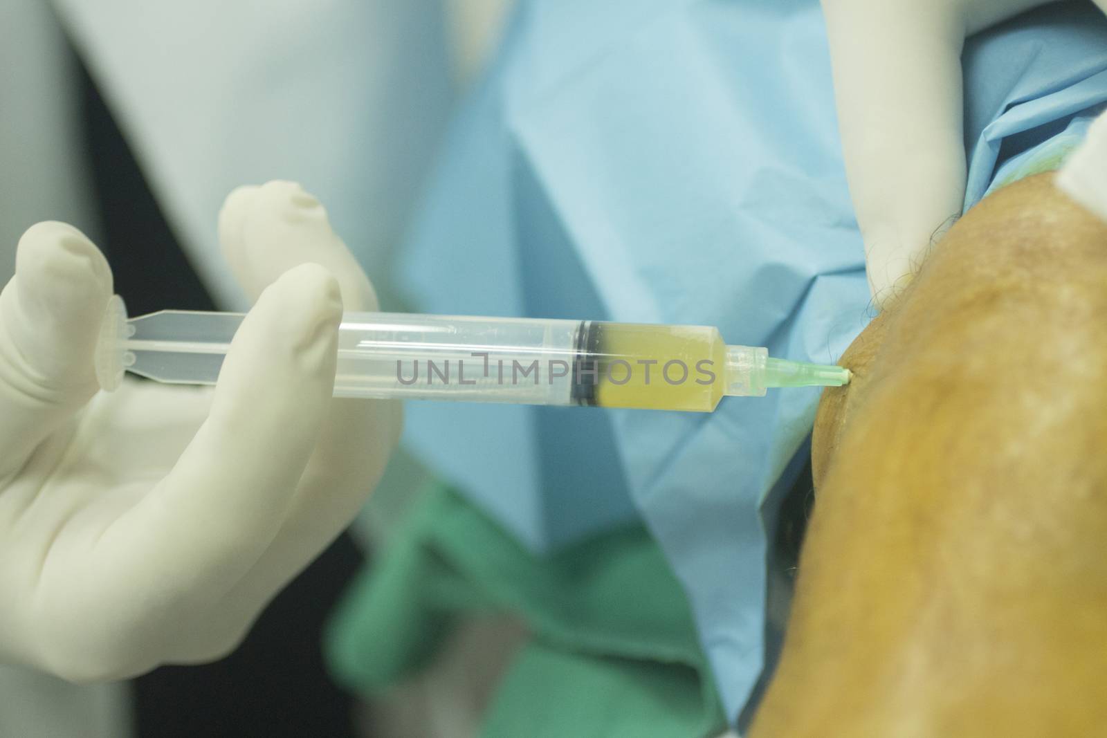 Close-up color photo of a female hospital clinic operating theater room surgeon wearing sterile blue gloves and senior male patient aged 65-70 receiving a an injection of human growth factors in his knee with sterilising liquid and sterile green hospital bed defocused background.