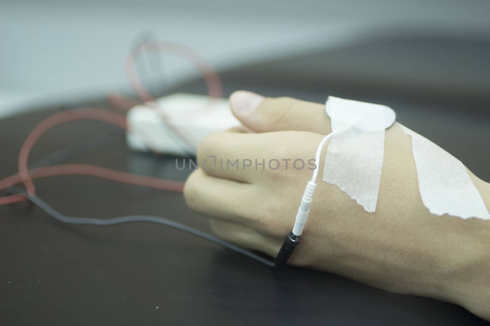 Color photo of a the hand of a young man in physiotherapy rehabiliation from traumatology with electrical stimulus attached with plaster with shallow depth of focus.