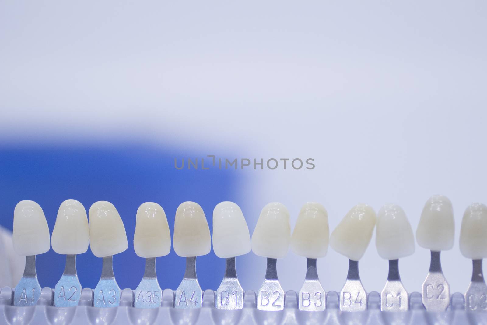 Dentist's tooth color guide used to choose the appropriate natural colors for a patient's tooth implants and crowns on plain white pastel light blue background of the dental surgery clinic table. Close-up macro photo. 