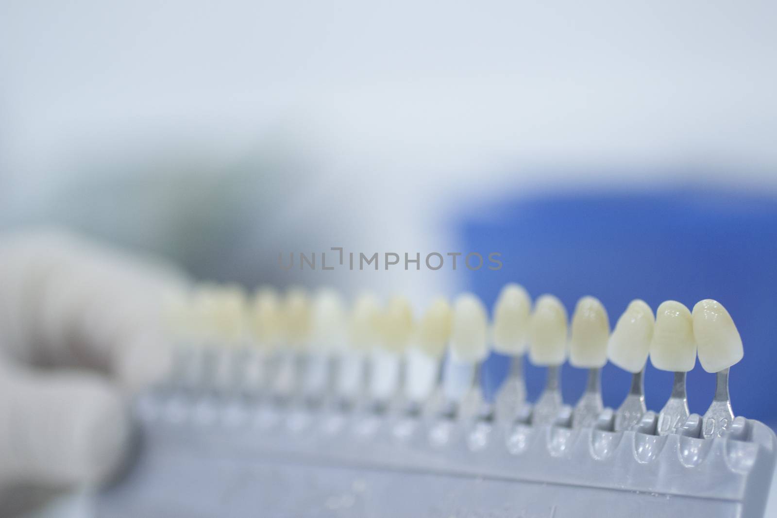 Hand of dental nurse in white sterile surgical glove holding the dentist's tooth color guide to choose appropriate natural colors for a patient's tooth implants and crowns on plain white pastel blue background of the dental surgery clinic table. 