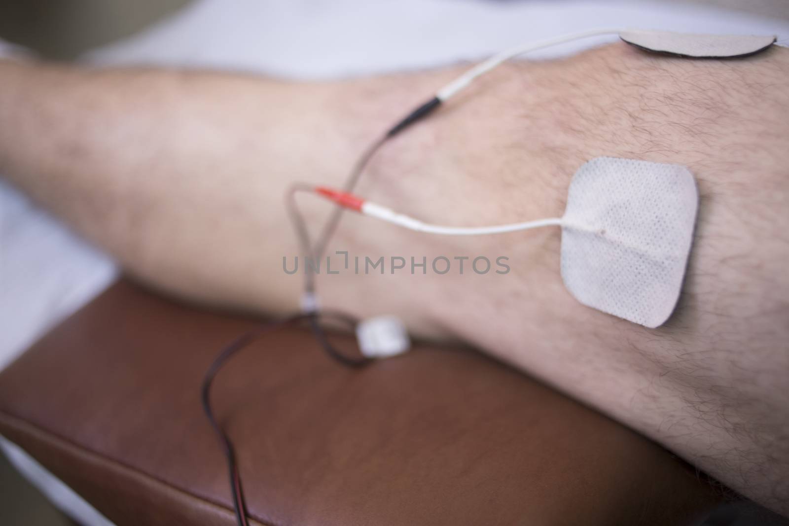 Color photo of a the side of thigh of leg of a man lying on hospital bed in medical physiotherapy rehabiliation from injury and traumatology operation surgery with electrical stimulus attached with plaster with shallow depth of focus.