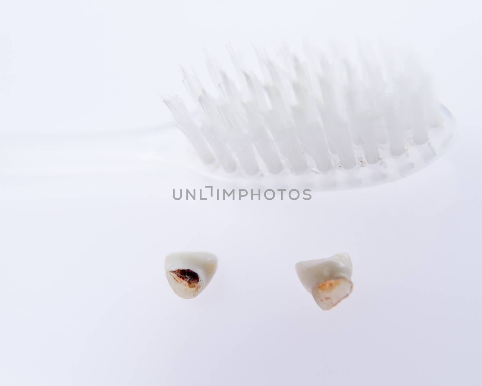 Teeth next to toothbrush by imagesbykenny