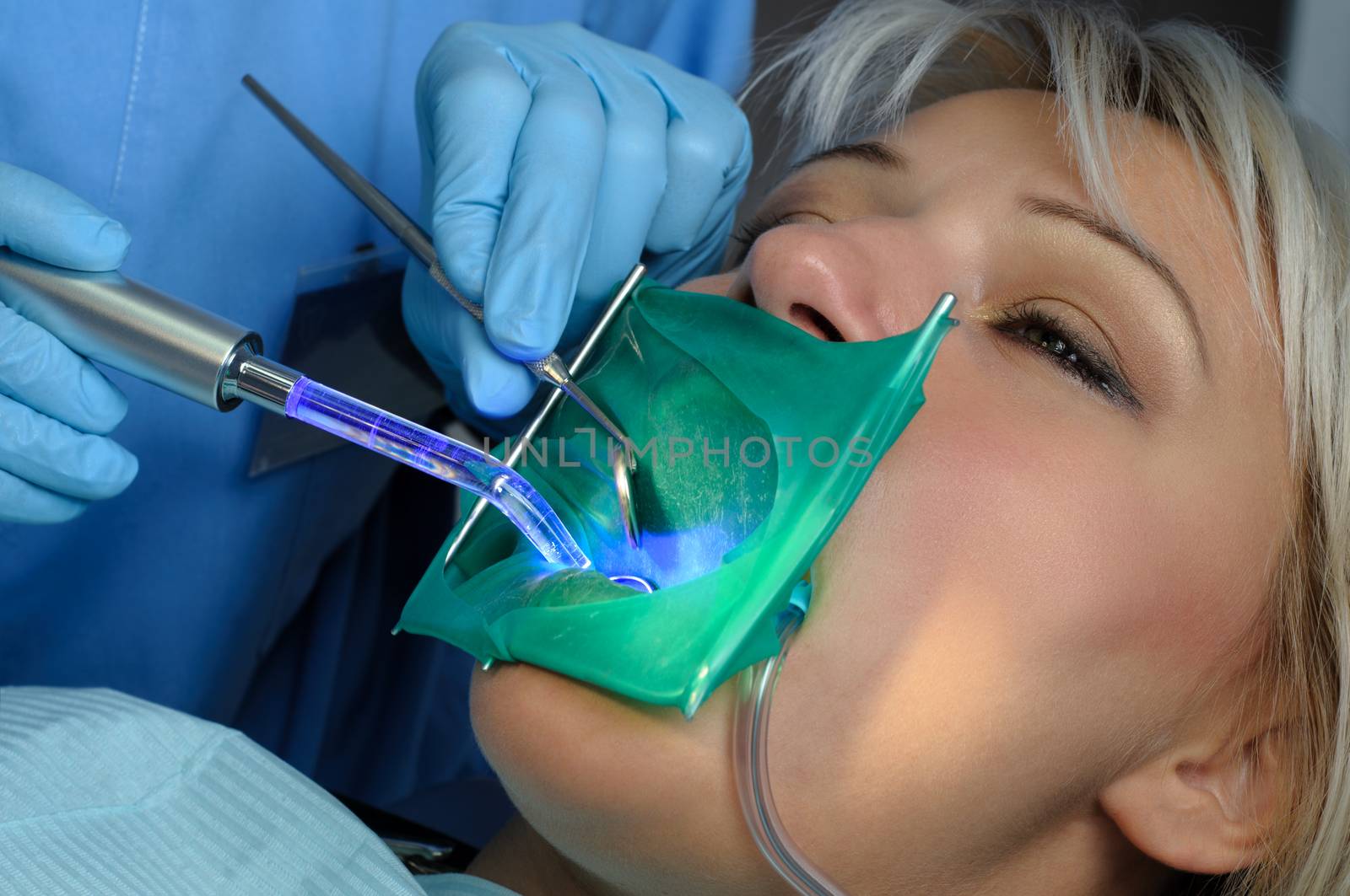 dentist with patient, using dental curing light by starush
