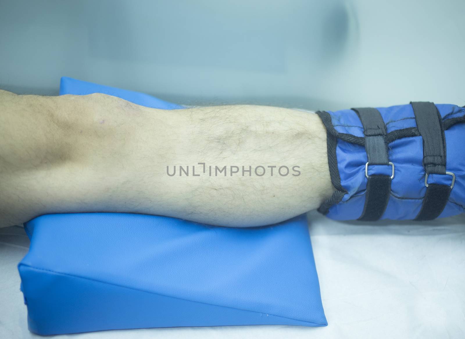 Leg of injured man in physiotherapy by edwardolive