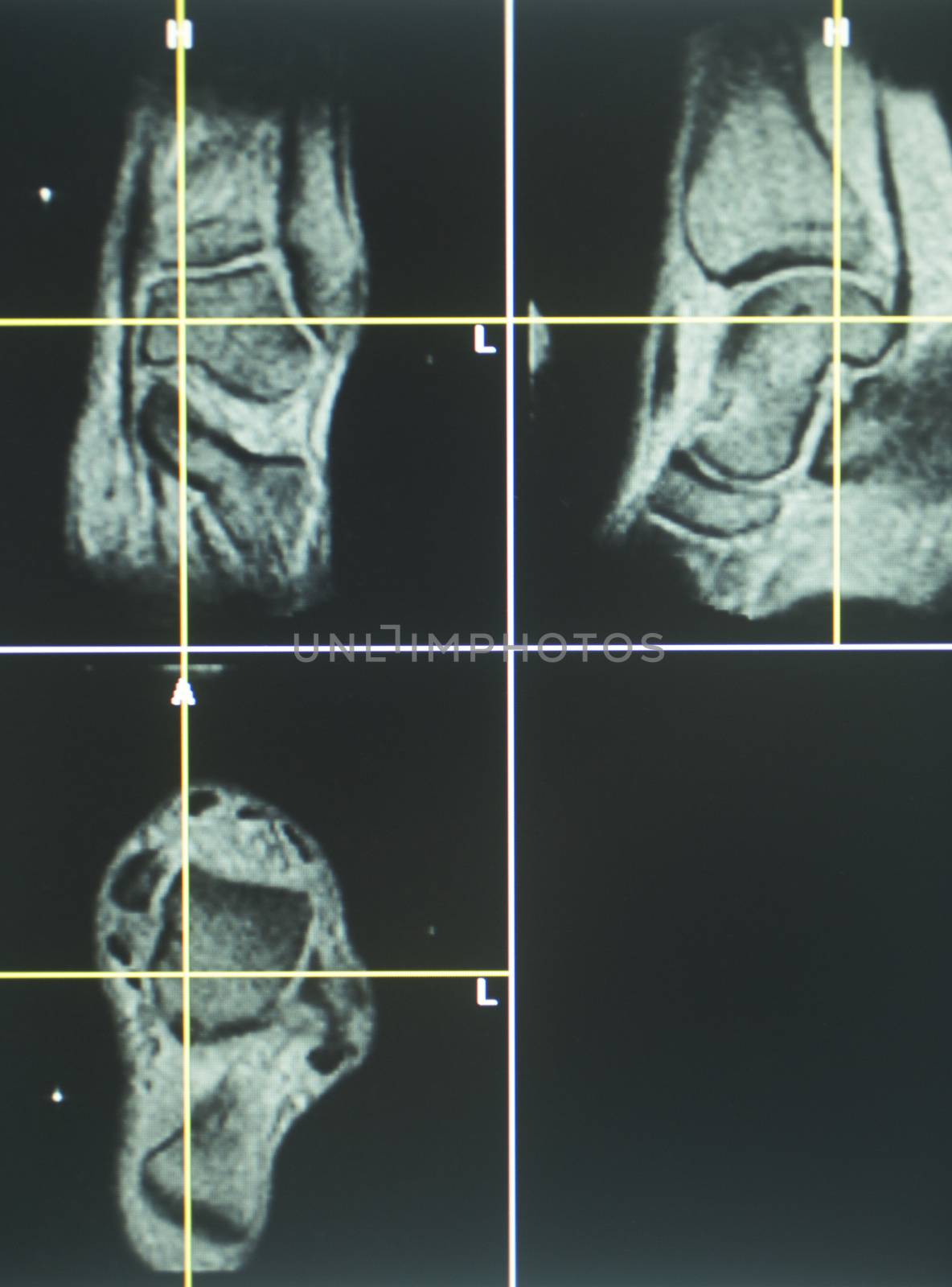 Examination of X-ray MRI CT on computer screen.
