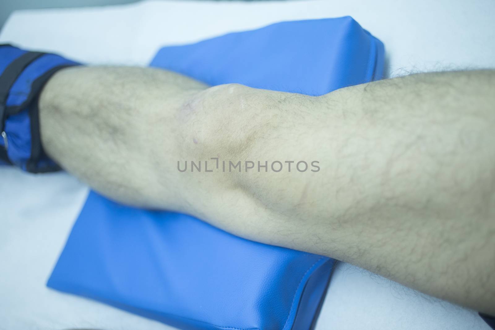 Leg of injured man in physiotherapy by edwardolive