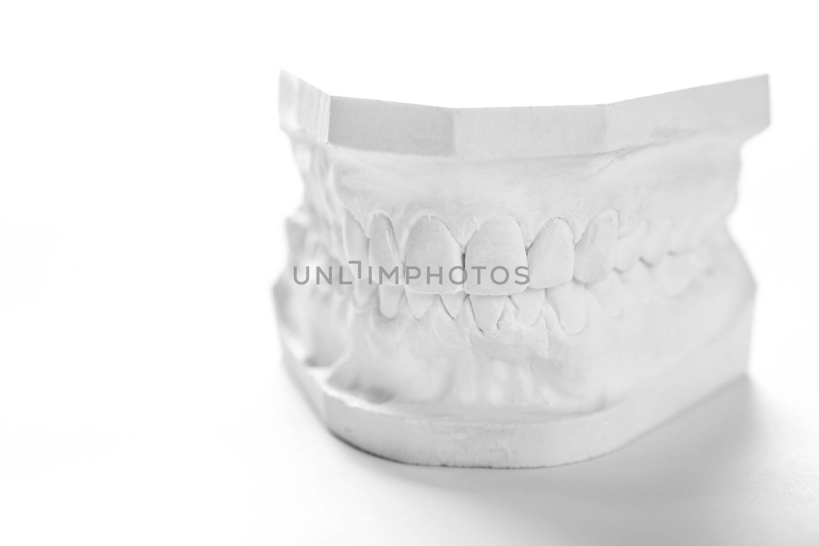 Dental casting gypsum model plaster cast stomatologic human jaws prothetic laboratory, technical shots