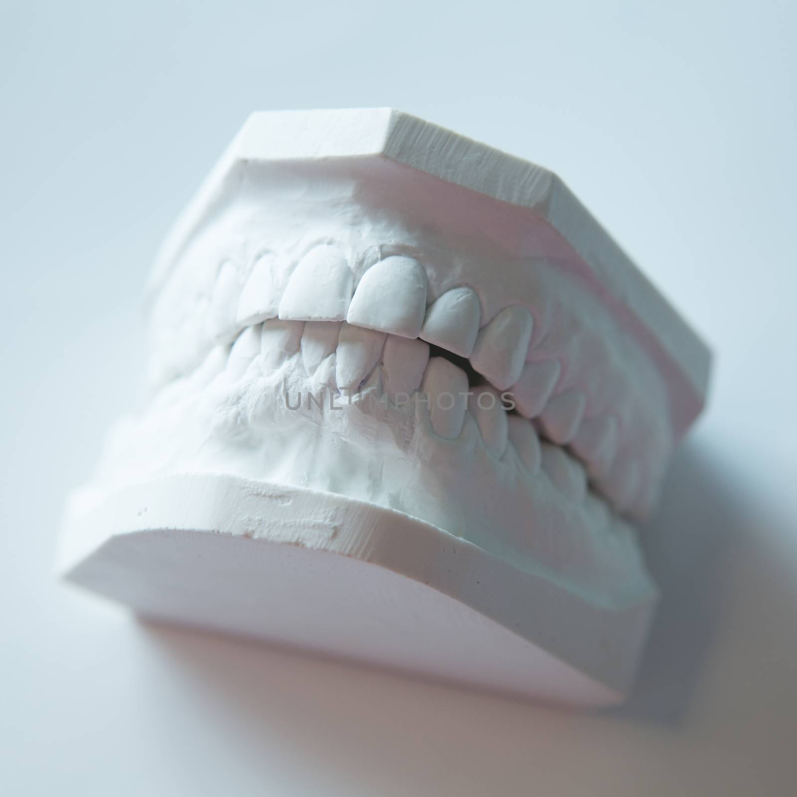 Dental casting gypsum model plaster cast stomatologic human jaws prothetic laboratory, technical shots