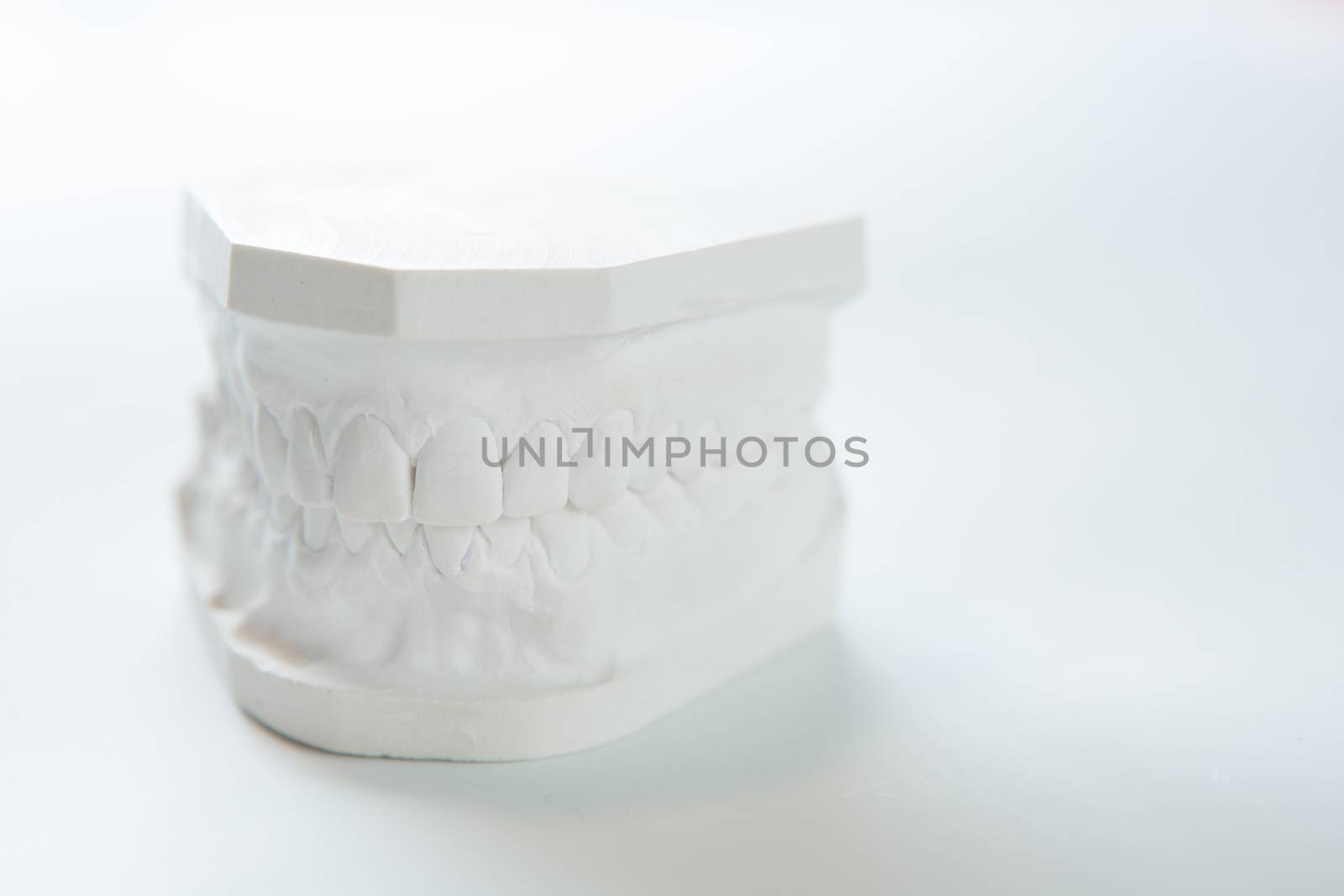 Gypsum model of human jaw on a white background. Selective Focus