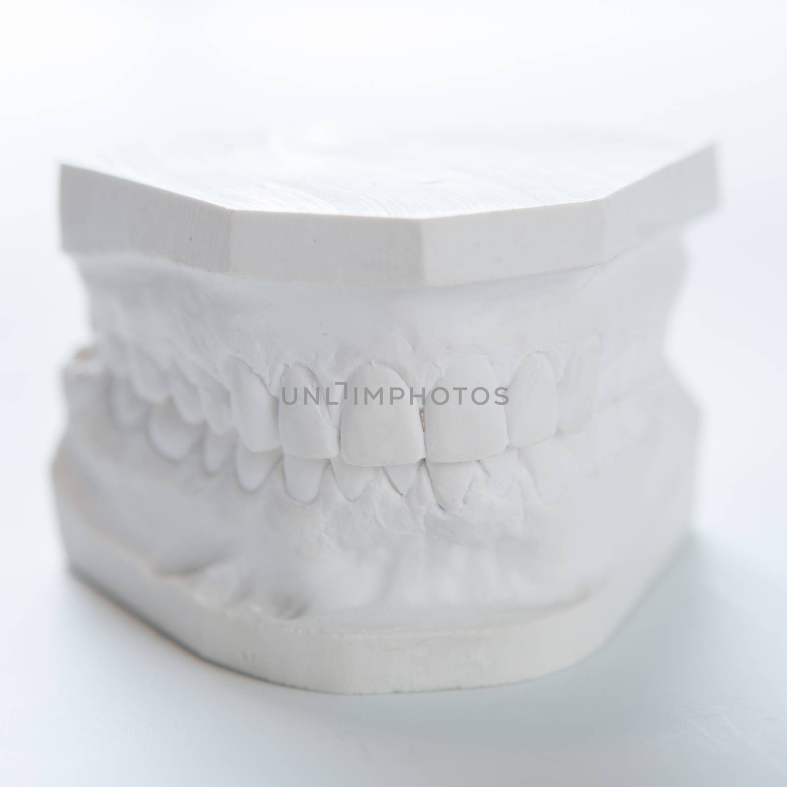 Gypsum model of human jaw on a white background. by sarymsakov
