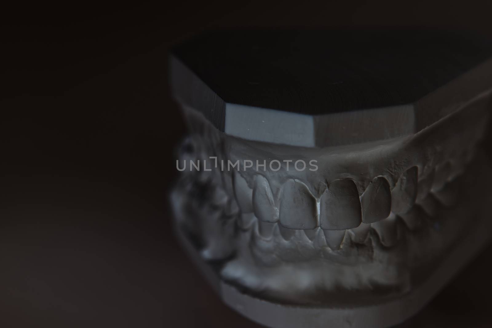 Gypsum model of human jaw on a white background. Selective Focus