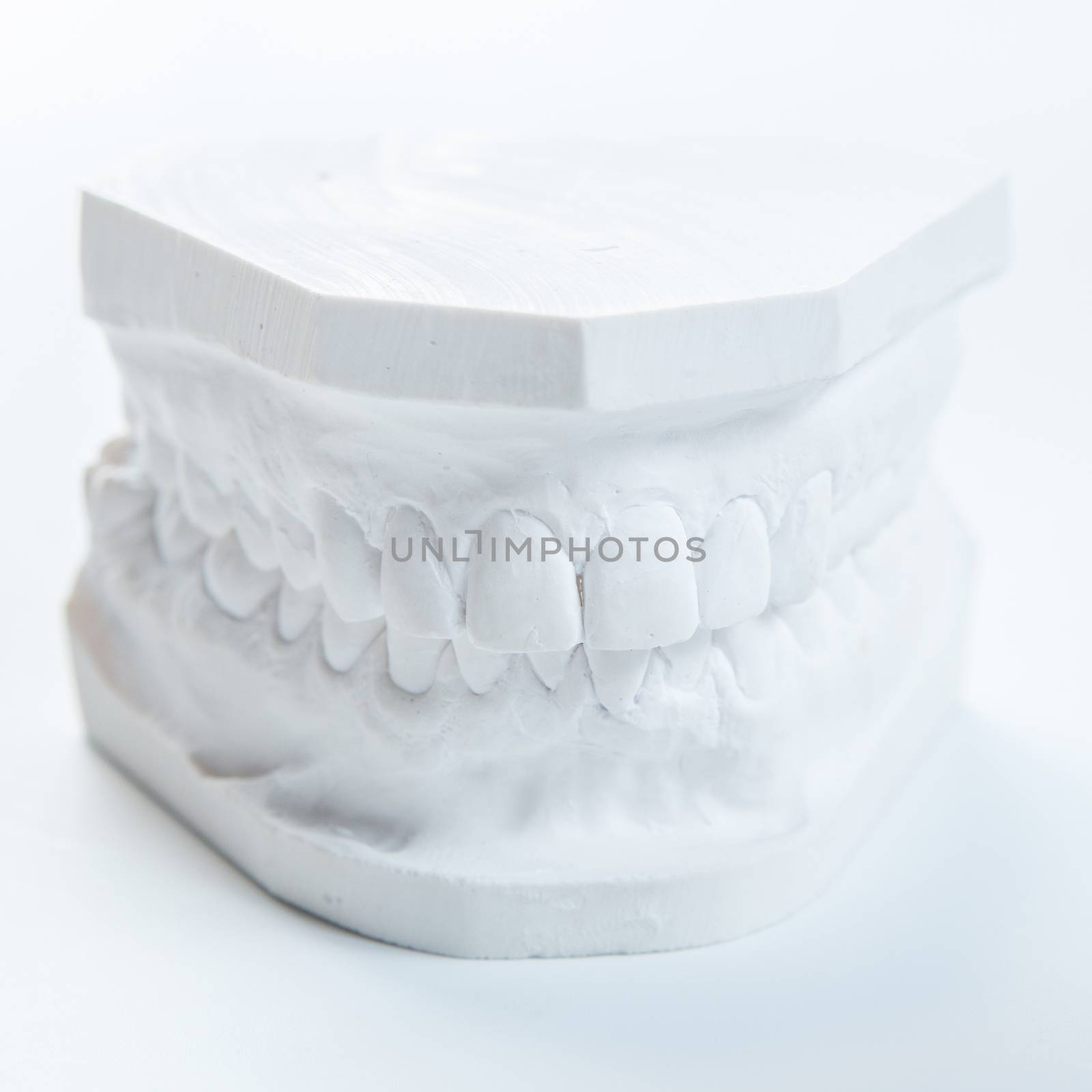 Dental casting gypsum model plaster cast stomatologic human jaws prothetic laboratory, technical shots