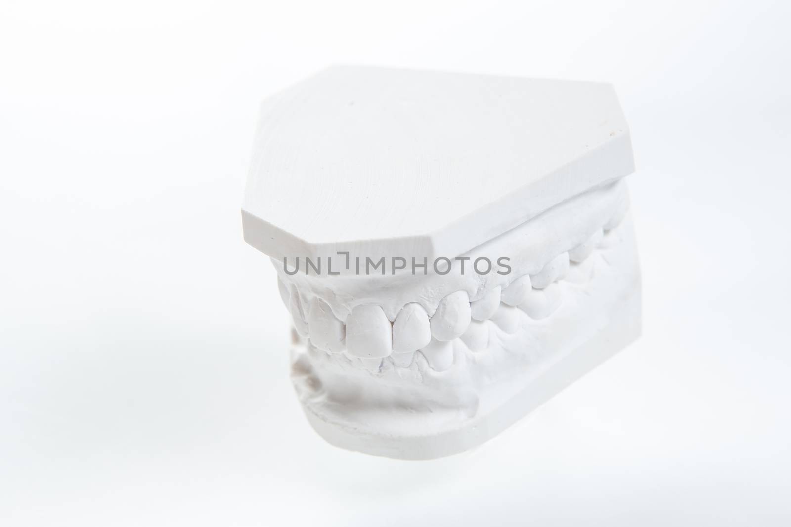 Gypsum model of human jaw on a white background. by sarymsakov