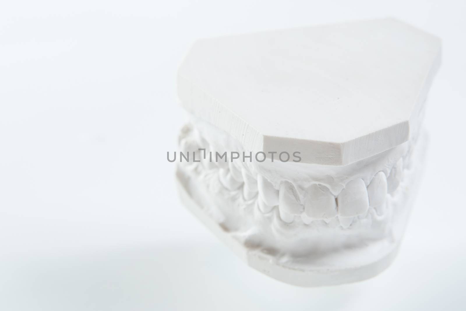 Gypsum model of human jaw on a white background. by sarymsakov