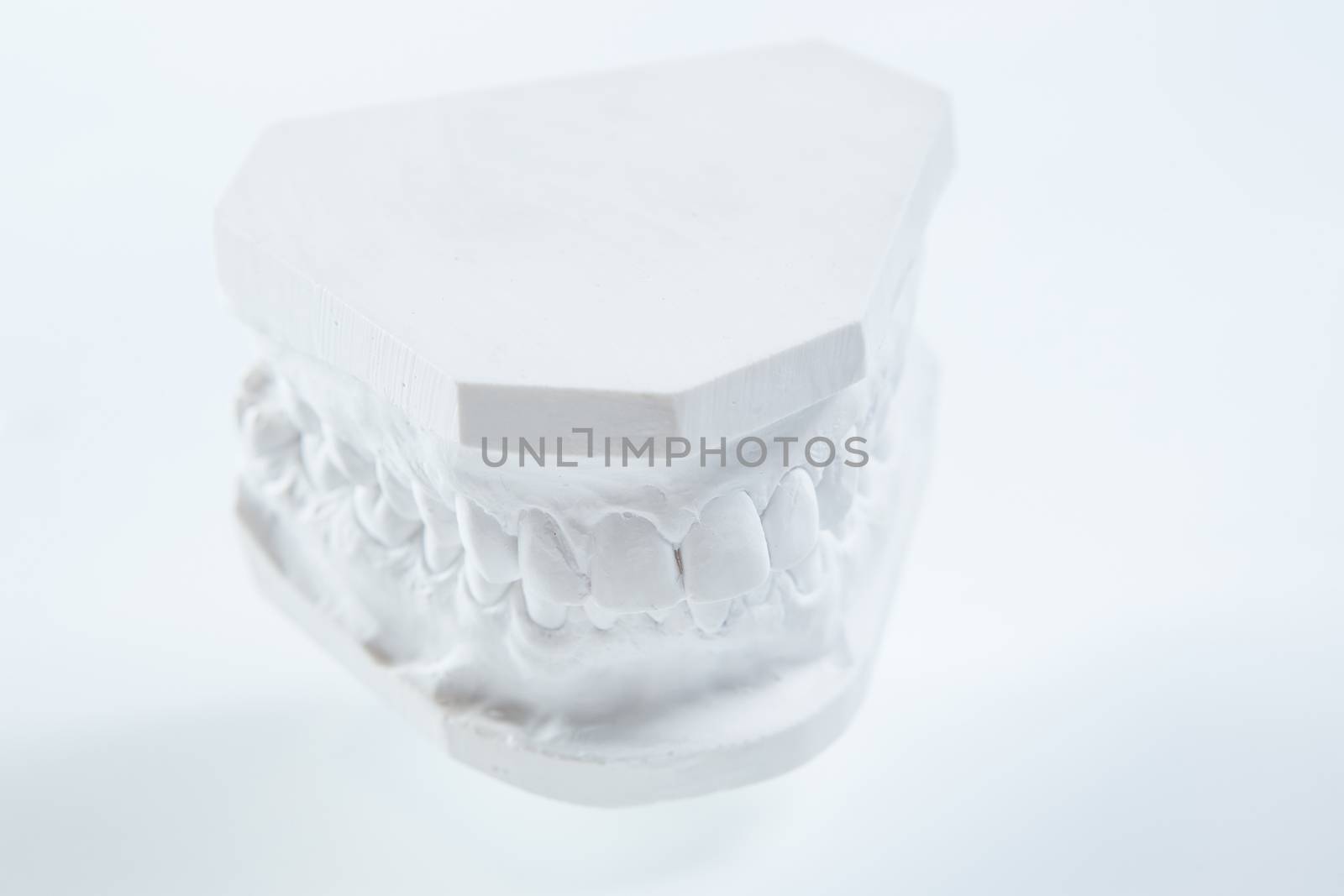 Dental casting gypsum model plaster cast stomatologic human jaws prothetic laboratory, technical shots