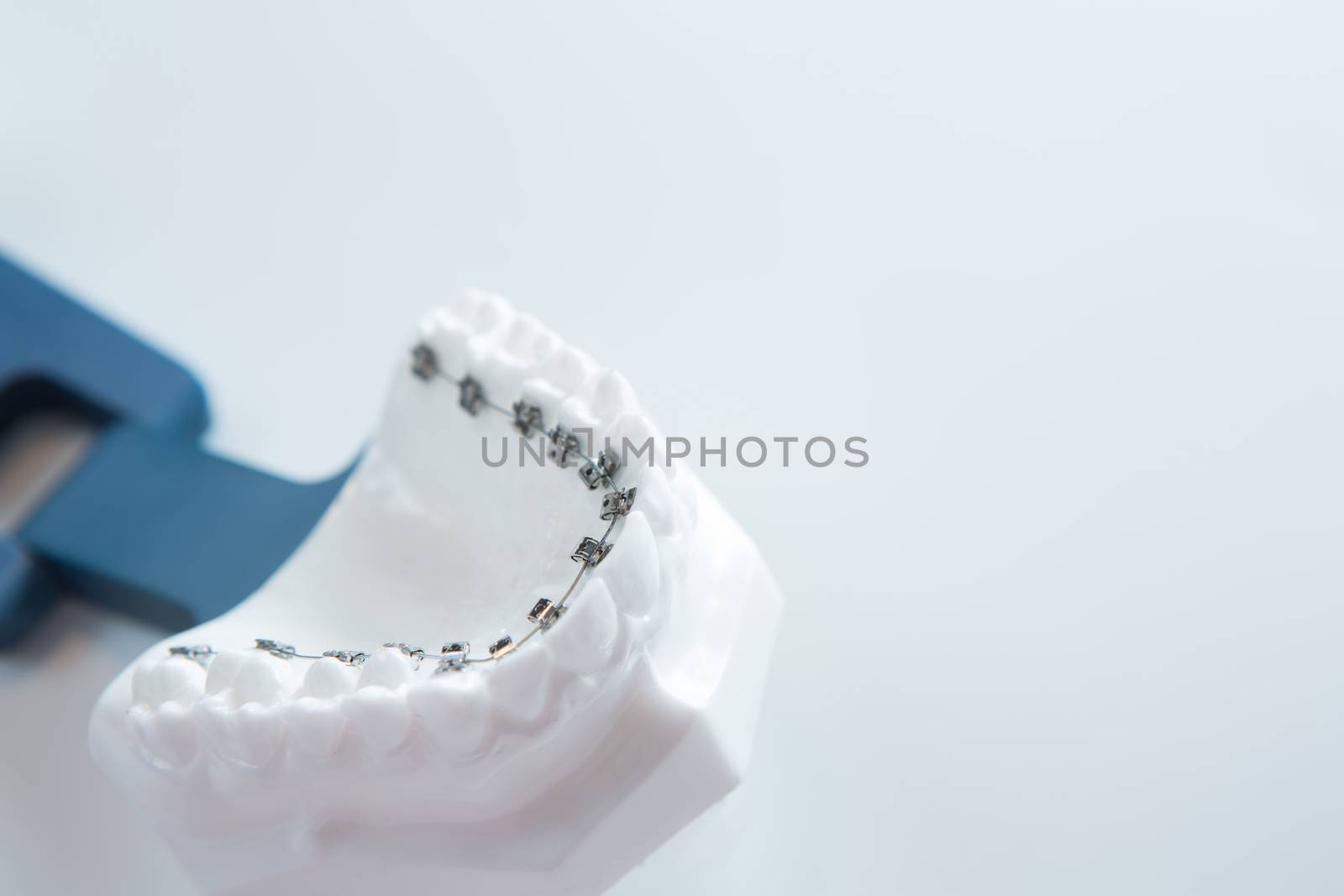 Dental lower jaw bracket braces model on white by sarymsakov