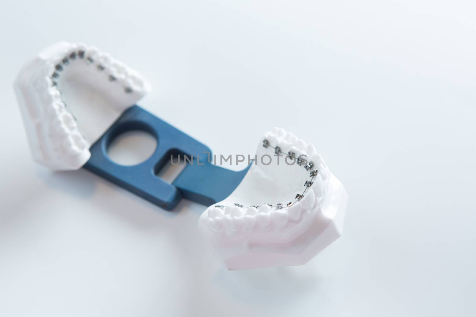 Dental lower jaw bracket braces model on white by sarymsakov