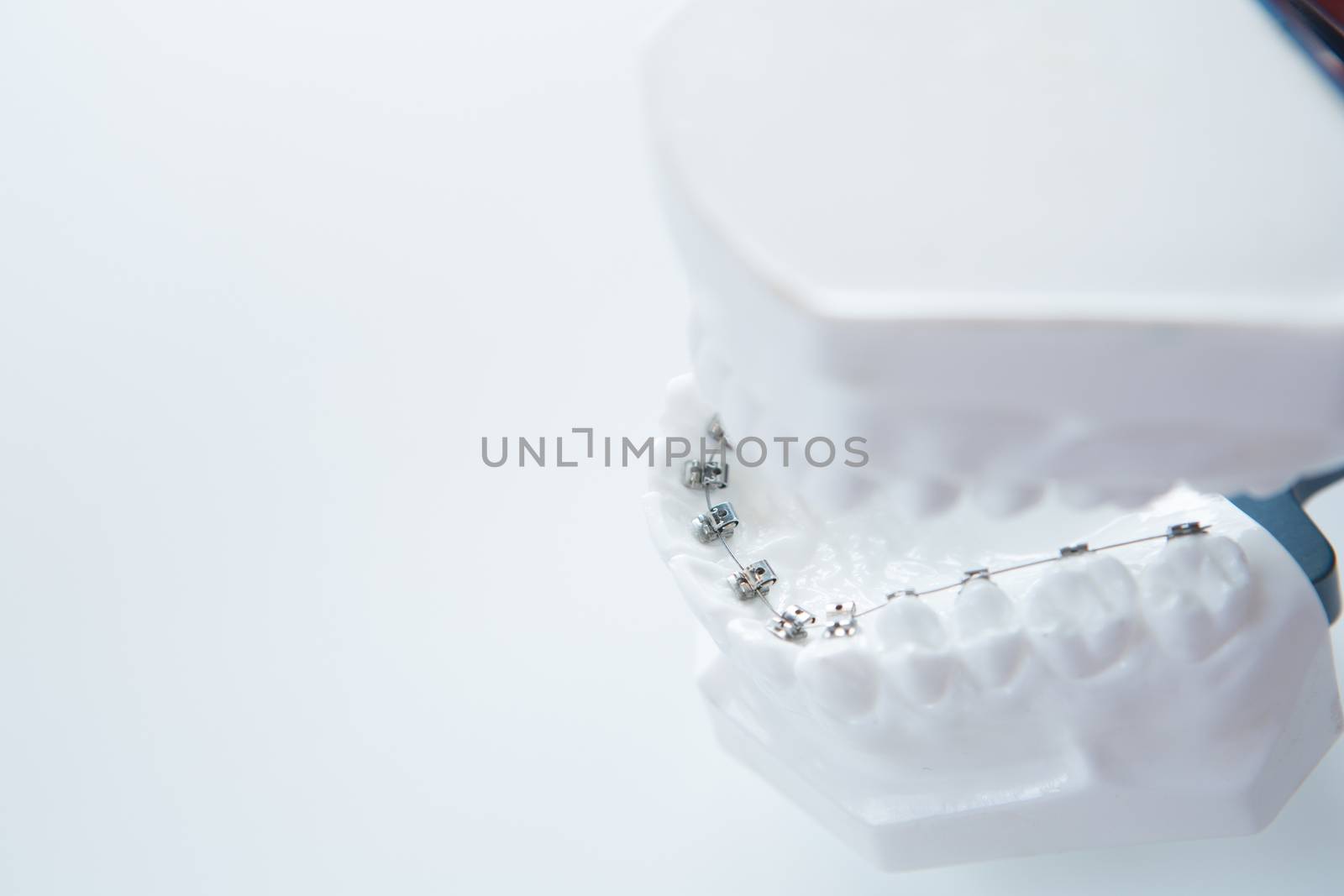 Dental lower jaw bracket braces model on white. Selective focus.