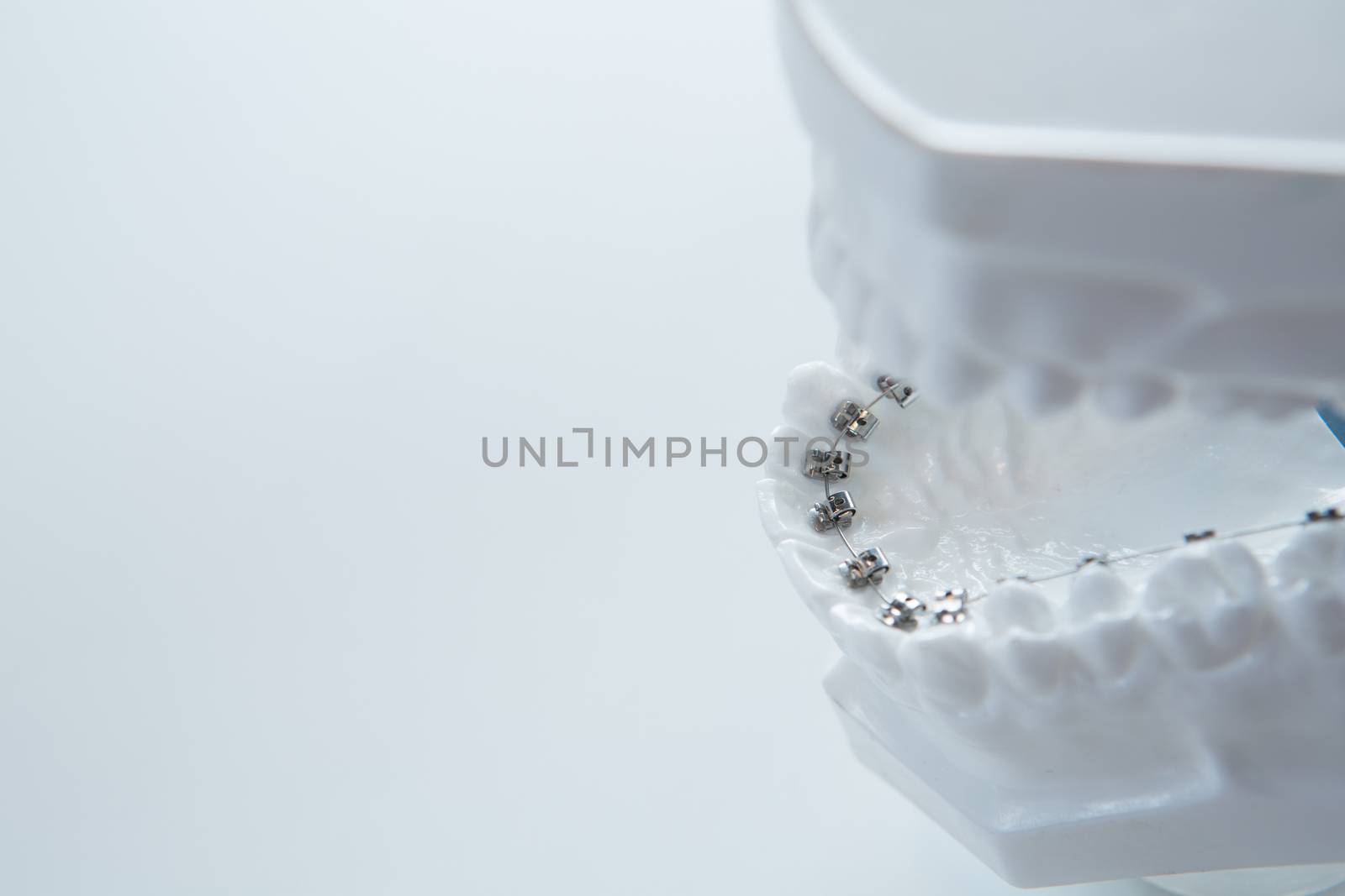 Dental lower jaw bracket braces model on white. Selective focus.