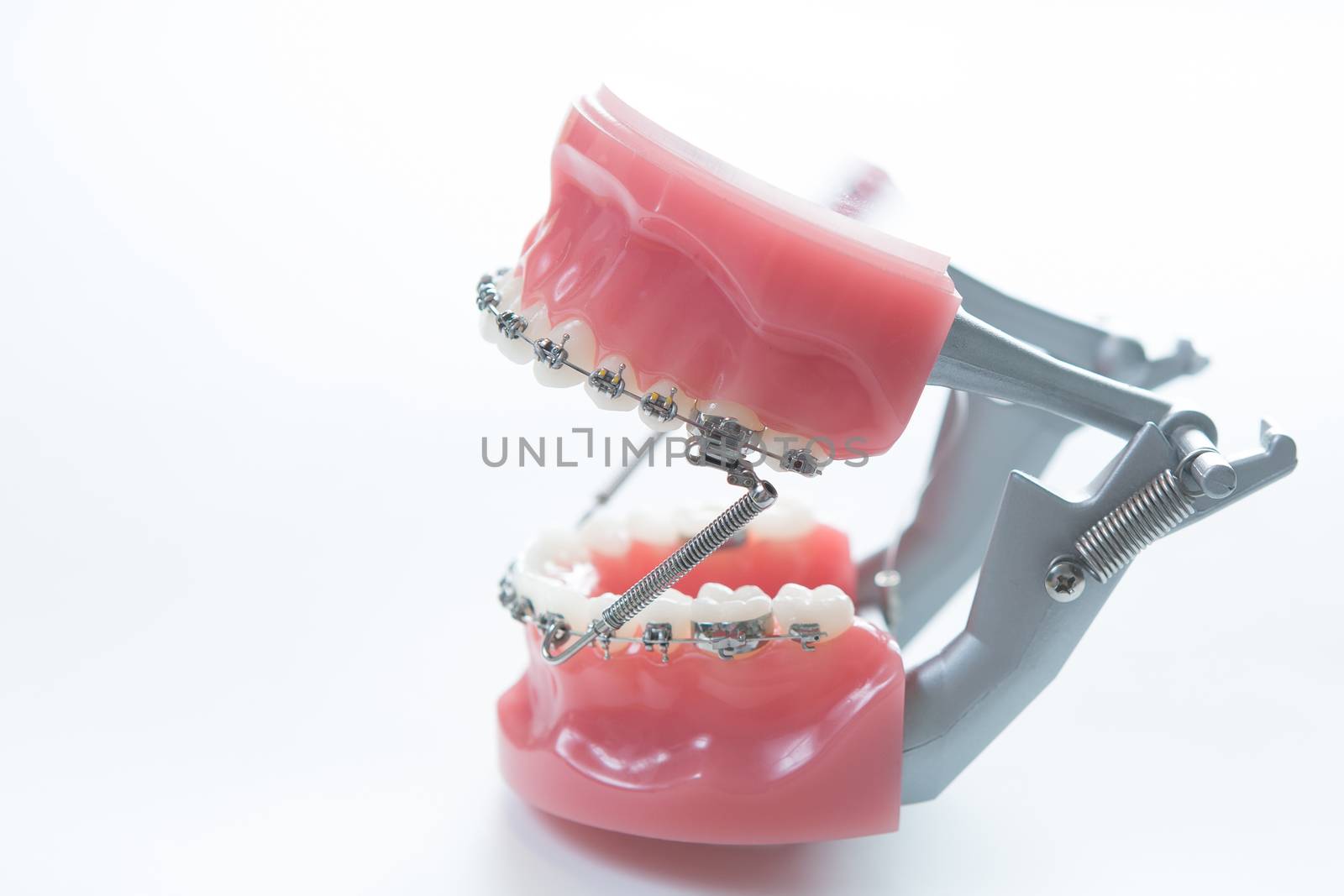 Dental lower jaw bracket braces model on white. Selective focus.