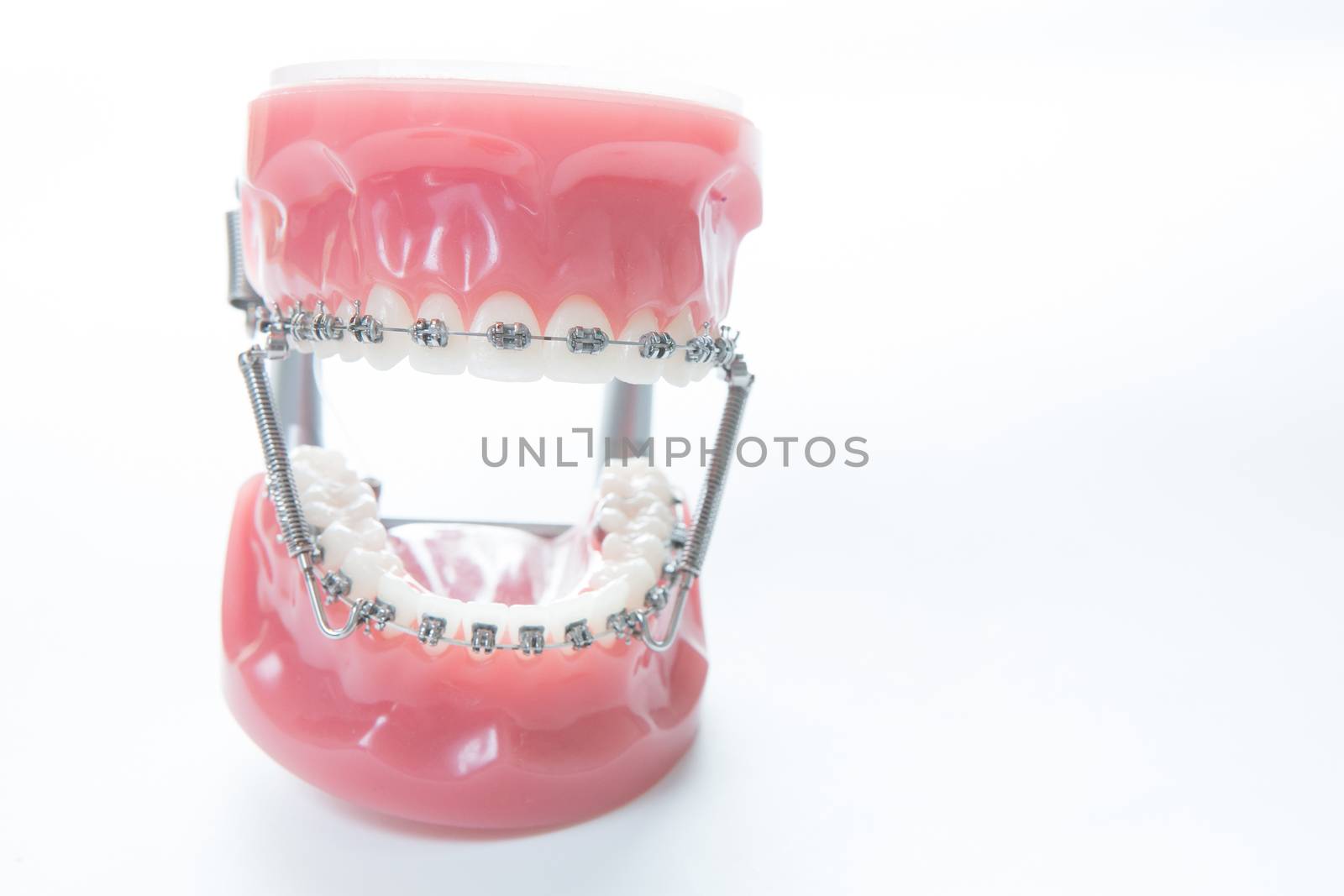 Dental lower jaw bracket braces model on white. Selective focus.