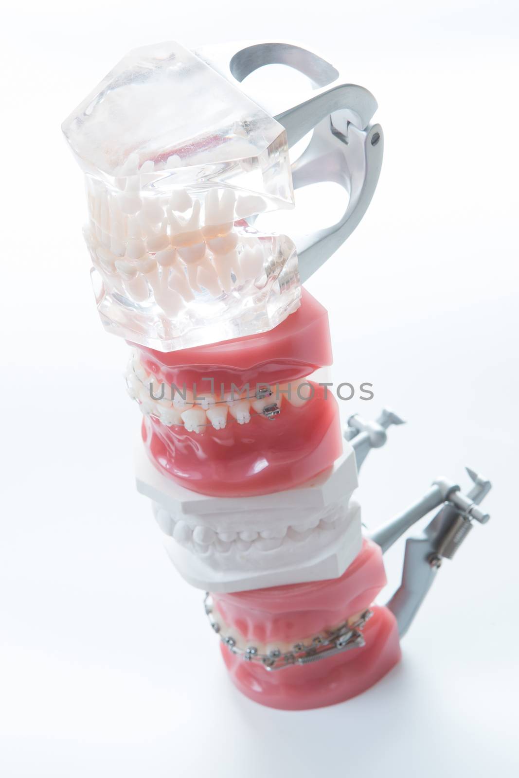 Dental model by sarymsakov