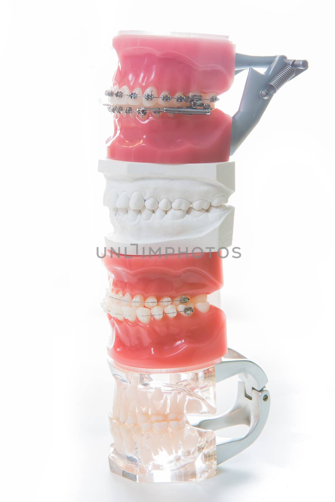 Dental model on white background. Selective focus