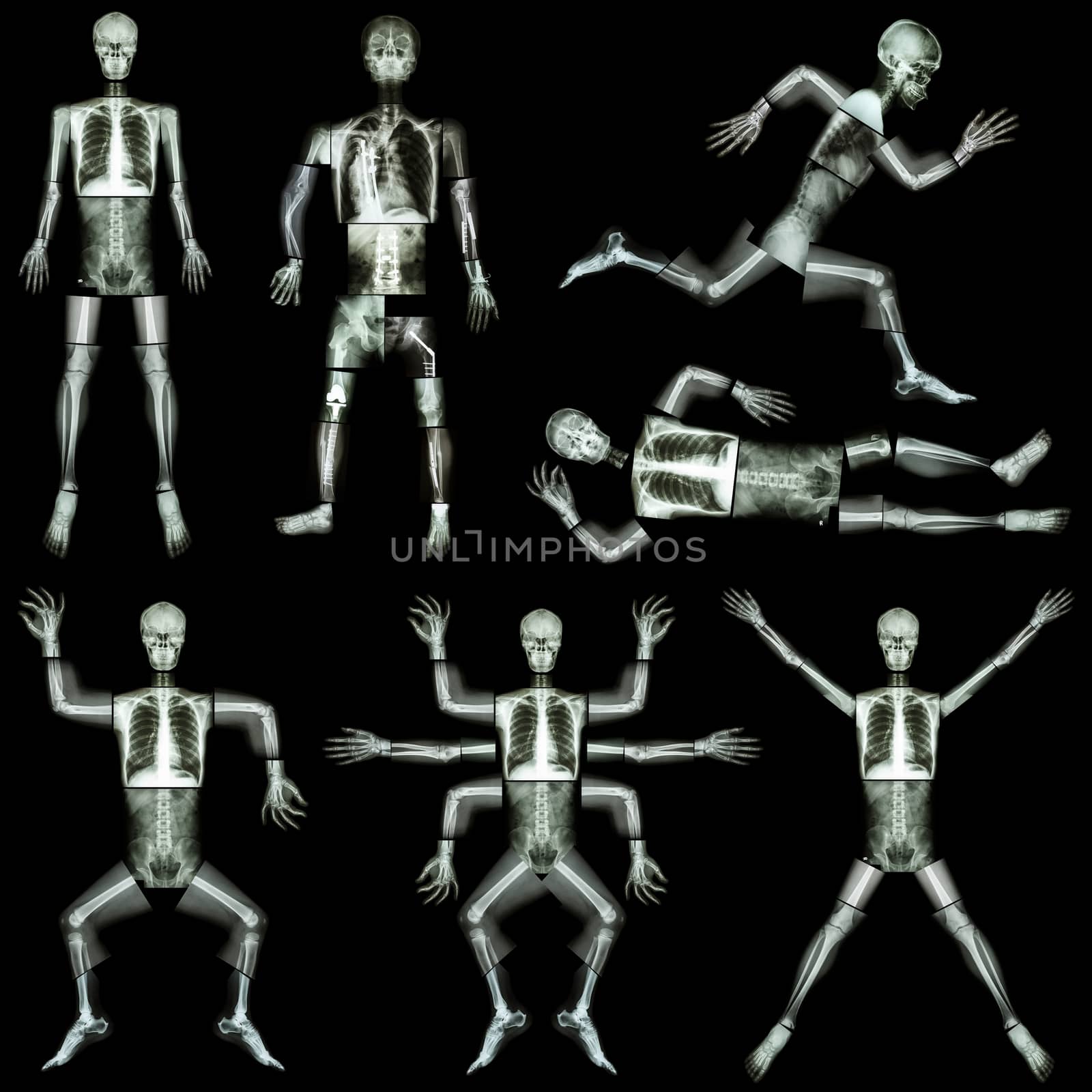 Collection of human skeleton (X-ray whole body : skull head face neck spine shoulder arm forearm elbow wrist hand finger thorax lung heart abdomen pelvis leg knee joint thigh foot ankle heel ) by stockdevil