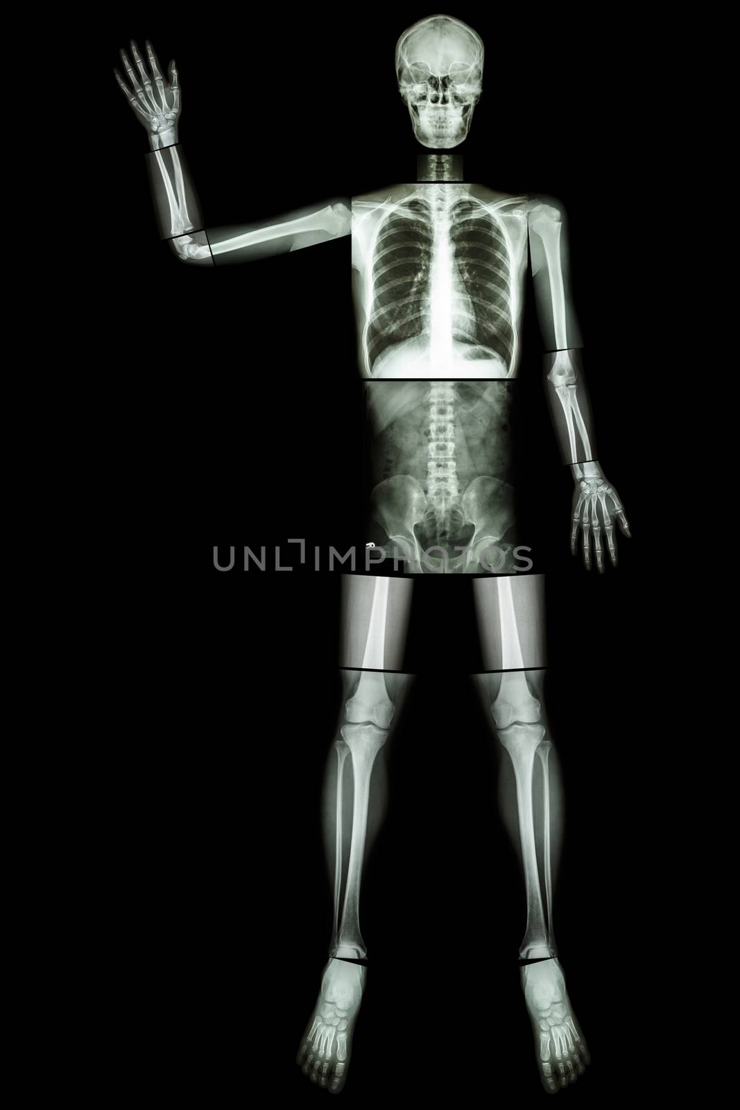 Good Bye EBOLA. (Human bone wave the hand) (Whole body : head neck spine shoulder arm elbow forearm wrist hand finger thorax heart lung back abdomen pelvis hip thigh leg knee foot ankle heel) by stockdevil