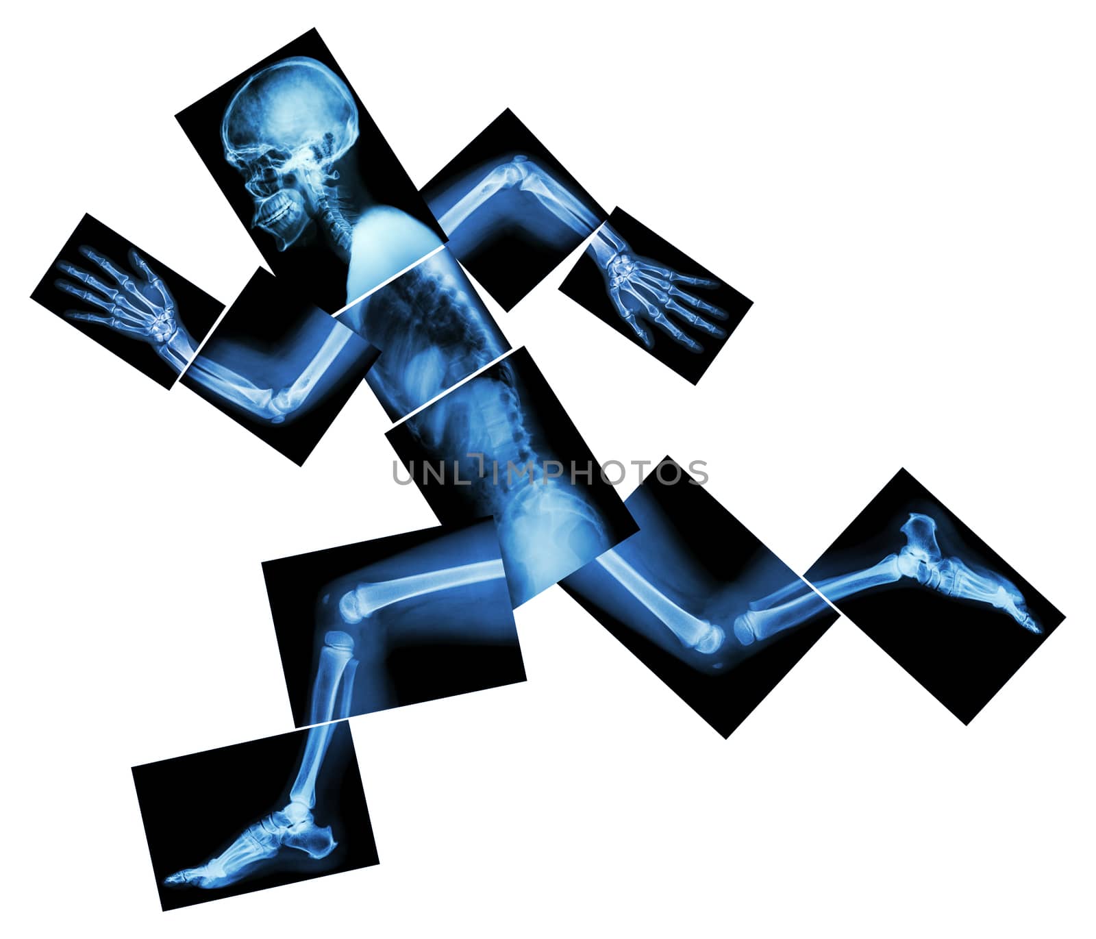 Marathon (human bone is running) ,(Whole body x-ray : head ,neck ,shoulder ,arm ,elbow ,forearm ,hand ,finger ,joint ,thorax ,abdomen ,back,pelvis ,hip ,thigh ,leg ,knee ,foot ,heel) by stockdevil