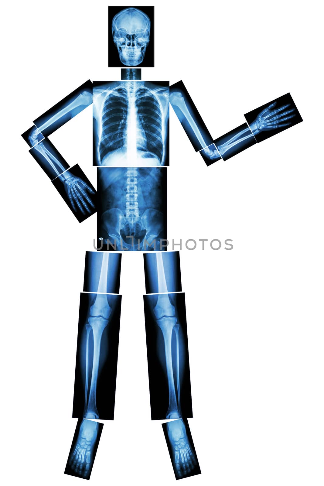 Human skeleton present something (Whole body : head skull neck spine shoulder arm elbow forearm wrist hand finger chest thorax heart lung abdomen back vertebra pelvis hip thigh knee leg ankle foot ) by stockdevil