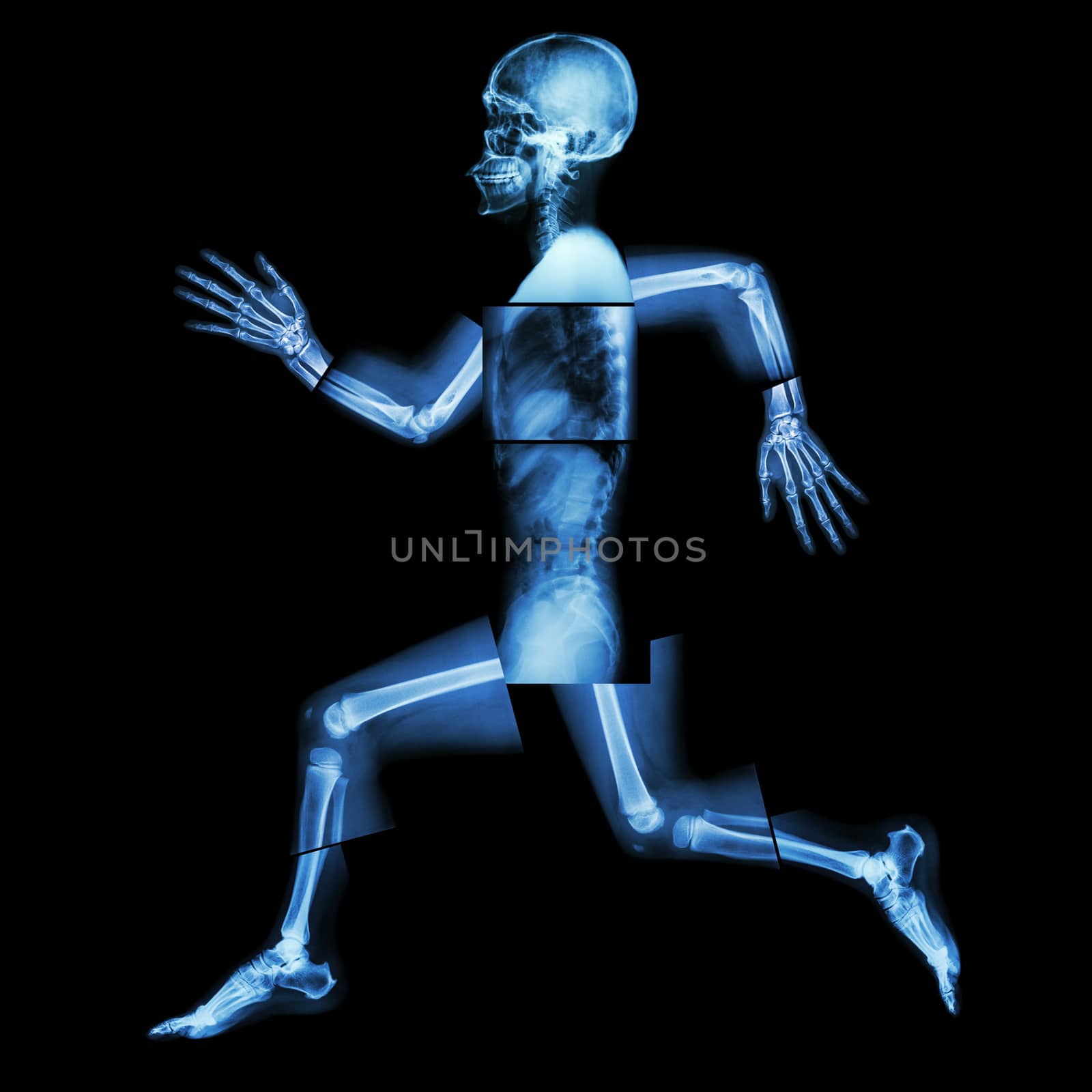 Aerobic Exercise (human bone is running) ,(Whole body x-ray : head ,neck ,shoulder ,shoulder ,arm ,elbow ,forearm ,hand ,finger ,joint ,thorax ,abdomen ,back,pelvis ,hip ,thigh ,leg ,knee ,foot ,heel) by stockdevil