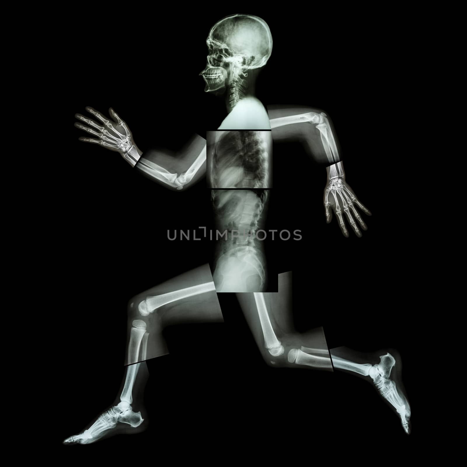 Aerobic Exercise (human bone is running) ,(Whole body x-ray : head ,neck ,shoulder ,shoulder ,arm ,elbow ,forearm ,hand ,finger ,joint ,thorax ,abdomen ,back,pelvis ,hip ,thigh ,leg ,knee ,foot ,heel) by stockdevil