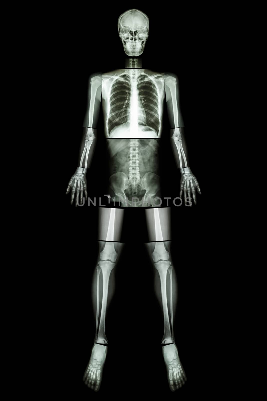 Anatomical Position. (X-ray whole body : head ,neck ,thorax ,heart ,lung ,rib ,shoulder ,scapula ,arm ,forearm ,elbow ,wrist ,hand ,digit ,abdomen ,hip ,pelvic ,leg ,thigh ,knee ,ankle ,heel ,foot ) by stockdevil