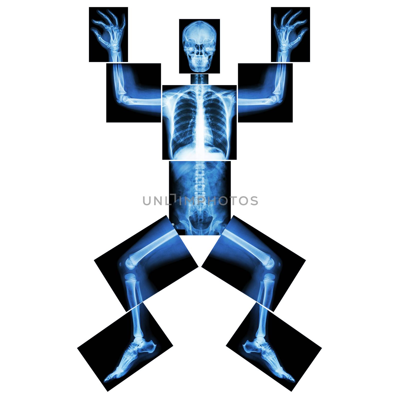 Jigsaw human x-ray ( whole body : head skull face neck spine shoulder arm elbow joint forearm wrist hand finger chest thorax heart lung rib abdomen back pelvis hip thigh knee leg ankle foot heel toe ) by stockdevil